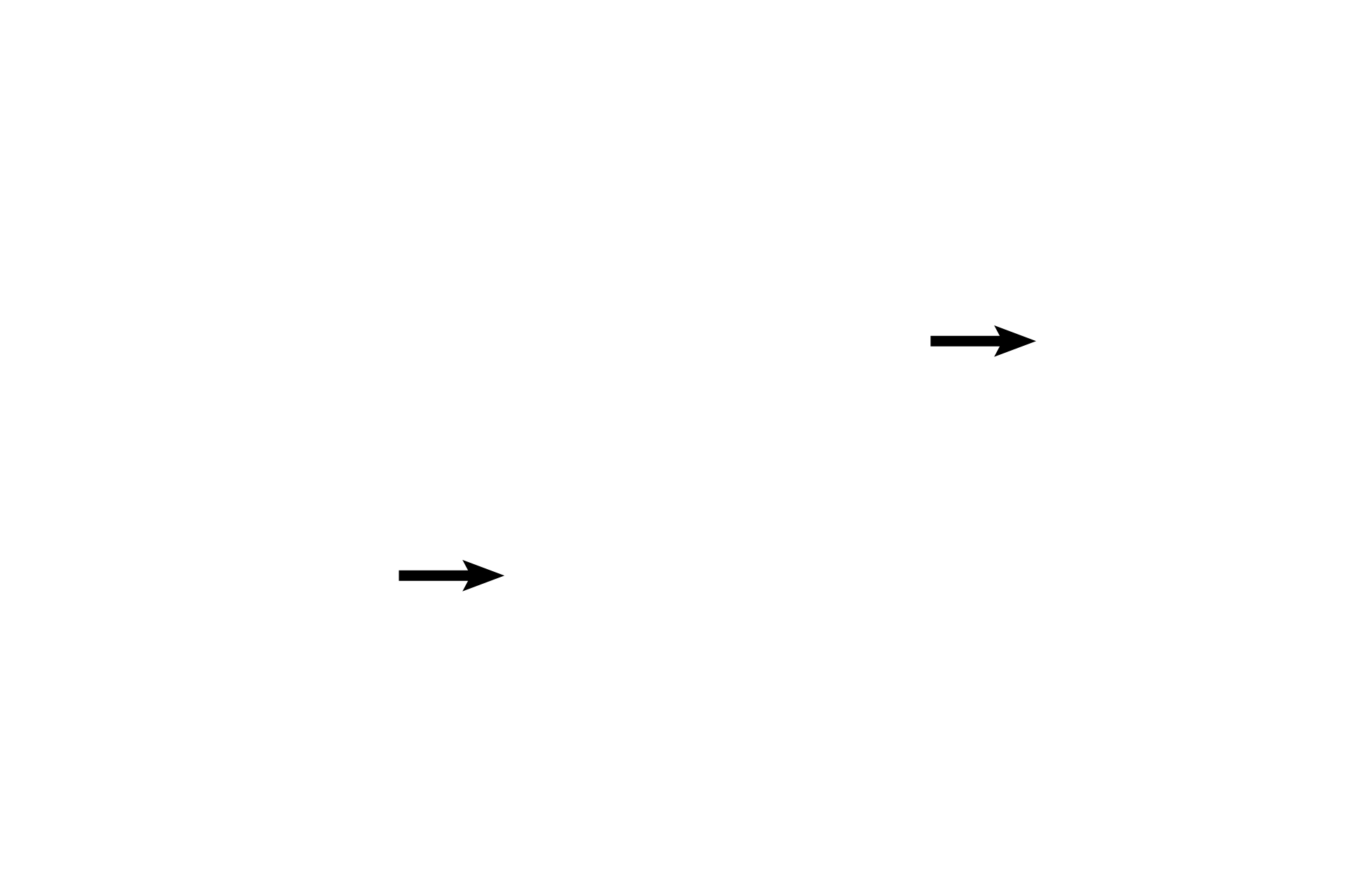 Type II cells <p>Pulmonary veins carry oxygenated blood from the pulmonary capillaries back to the left atrium. These vessels do not accompany the smaller respiratory passageways; instead, they travel alone, frequently seen in the connective tissue septa that subdivide the lung. 100x</p>
