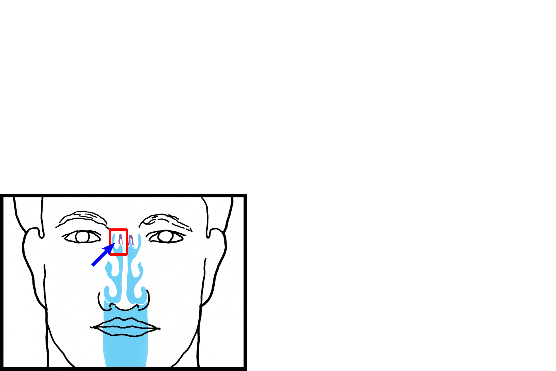 Orientation > <p>The outline in the inset shows the location from which this section was taken, including the superior concha (arrow) extending into the superior region of the nasal cavity. The location of the olfactory epithelium covering the medial surface of this concha is colored purple; non-olfactory epithelium lines the lateral surface of the concha.</p>
