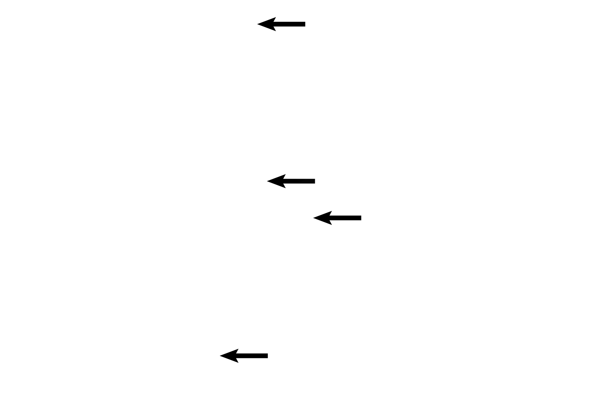  - Sensory nerves <p>Olfactory epithelium lines the medial surface of the superior concha. This pseudostratified columnar epithelium with cilia is markedly thicker than that of respiratory regions. The underlying lamina propria is also thicker, filled with serous secreting Bowman’s glands and cranial sensory nerves supplying both general and special sensations.  </p>
