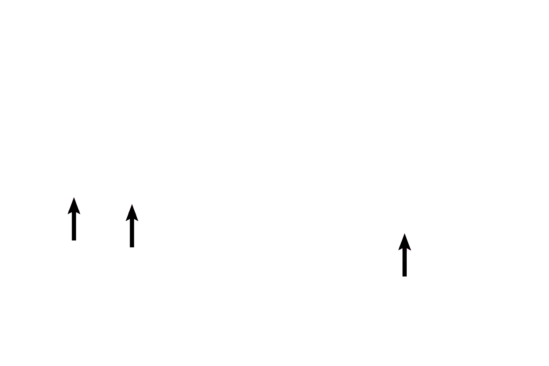 Mixed glands <p>This trachea, cut in longitudinal section, is lined by pseudostratified columnar epithelium with cilia and goblet cells. An underlying lamina propria possesses numerous, longitudinally oriented elastic fibers and bands of smooth muscle (neither of which are distinguishable at this magnification). Mixed glands are also present. Patency is maintained by cartilage rings, and a layer of connective tissue surrounds the outer perimeter of the cartilage. 10x</p>
