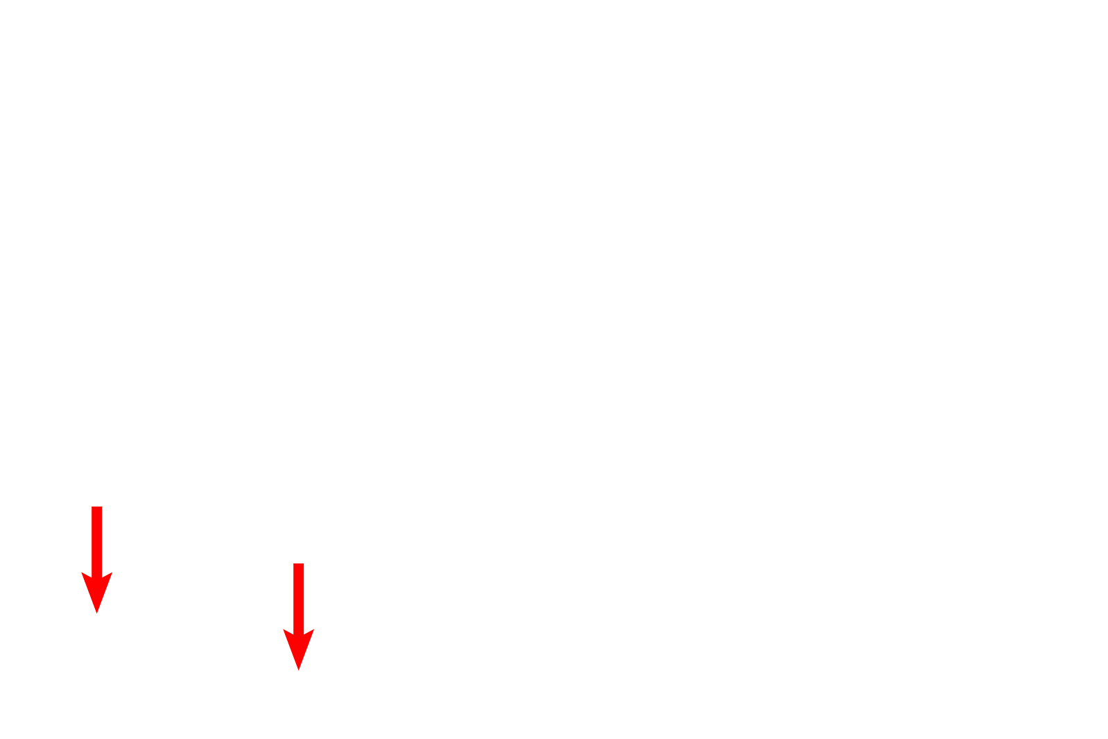 Perichondrium <p>Another image of the trachea or primary bronchus demonstrates the components forming the wall of these passageways. 100x</p>
