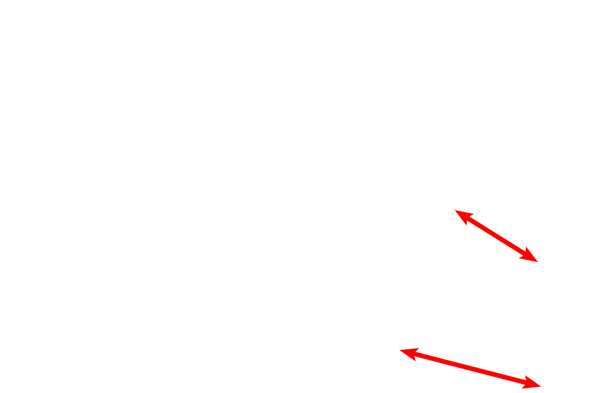 Epithelium <p>Another image of the trachea or primary bronchus demonstrates the layers adjacent to the lumen. The longitudinally oriented elastic fibers in the elastic lamina are seen cut in cross section. No smooth muscle layer is visible in this image. 400x</p>
