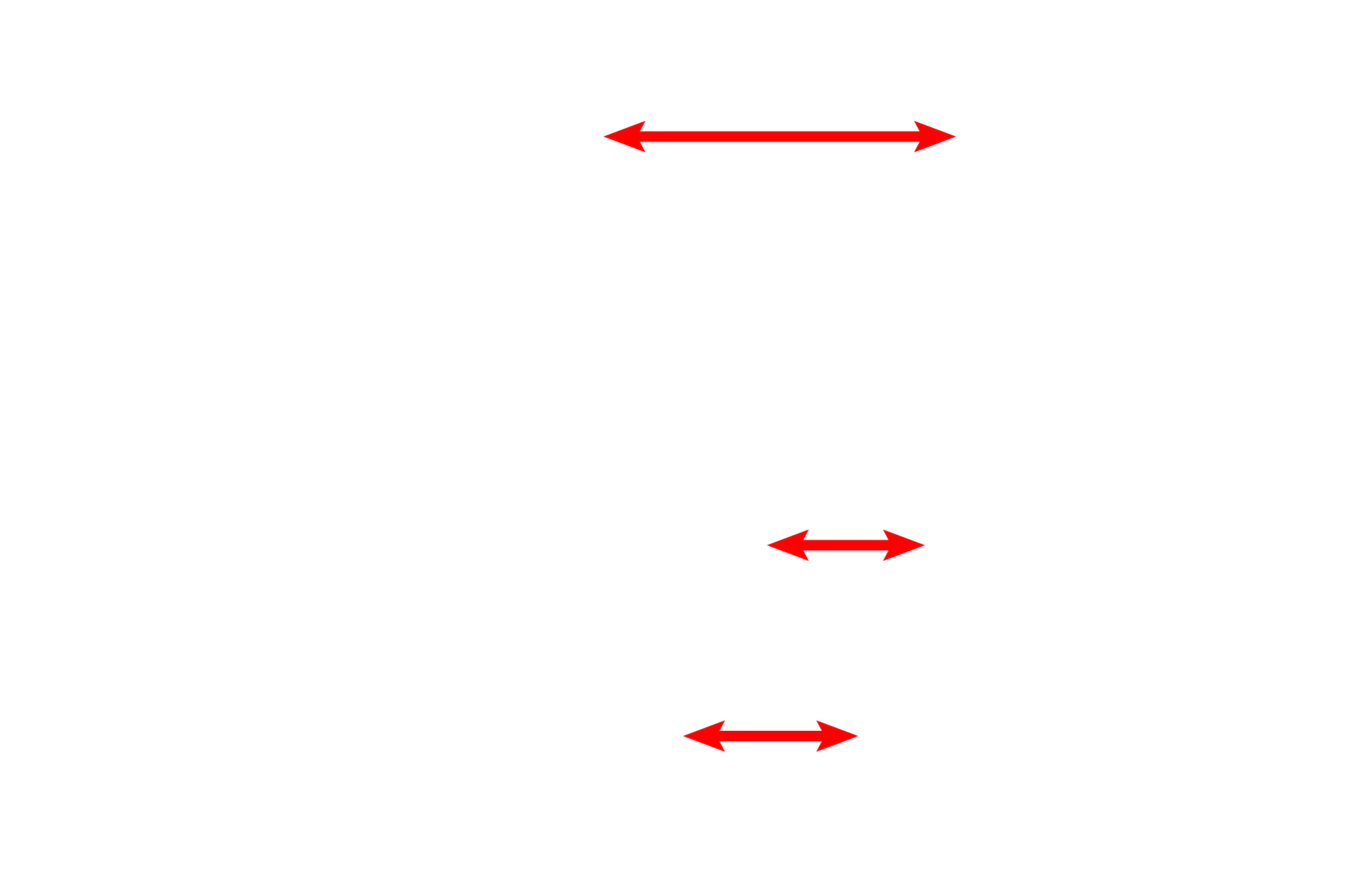 - Elastic lamina <p>Another image of the trachea or primary bronchus demonstrates the layers adjacent to the lumen. The longitudinally oriented elastic fibers in the elastic lamina are seen cut in cross section. No smooth muscle layer is visible in this image. 400x</p>
