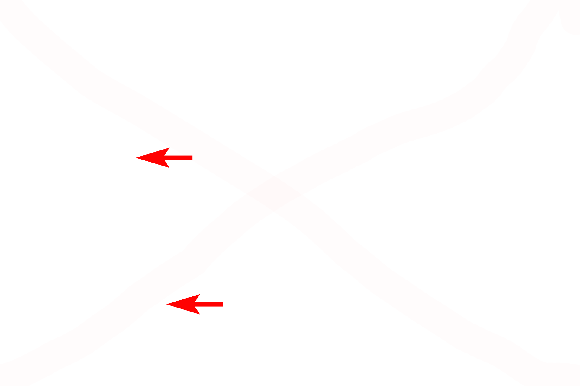  - Ducts <p>Another image of the trachea or primary bronchus demonstrates the layers adjacent to the lumen. The longitudinally oriented elastic fibers in the elastic lamina are seen cut in cross section. No smooth muscle layer is visible in this image. 400x</p>
