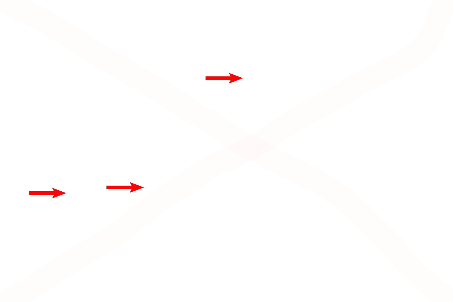  - Elastic fibers <p>The elastic lamina of the trachea and primary bronchi is composed of longitudinally oriented elastic fibers that are organized into a discrete band, the elastic lamina. Cells of the immune system, such as the plasma cells seen here, are prevalent in the connective tissue of the respiratory system.  1000x</p>
