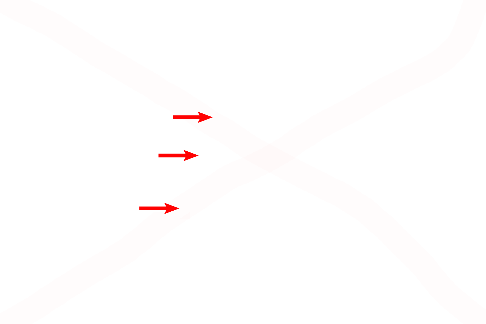  - Plasma cells <p>The elastic lamina of the trachea and primary bronchi is composed of longitudinally oriented elastic fibers that are organized into a discrete band, the elastic lamina. Cells of the immune system, such as the plasma cells seen here, are prevalent in the connective tissue of the respiratory system.  1000x</p>
