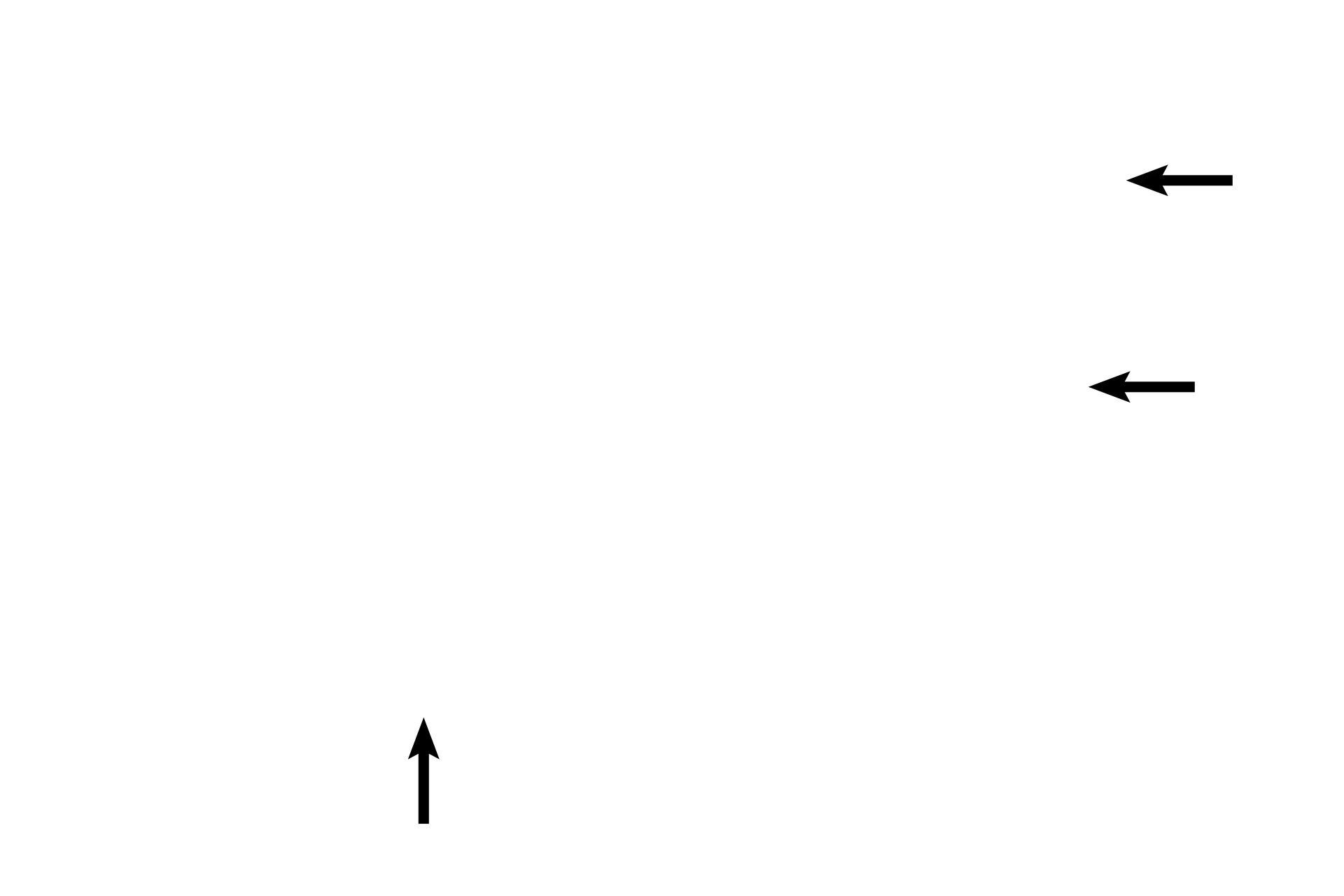  - Smooth muscle <p>At higher magnification the components of the wall of a bronchiole are apparent. This is a larger bronchiole because it is lined by pseudostratified columnar epithelium with cilia and goblet cells.  Abundant, longitudinally arranged elastic fibers are located beneath the epithelium. The smooth muscle layer is composed of spiraling bands of smooth muscle. 200x</p>
