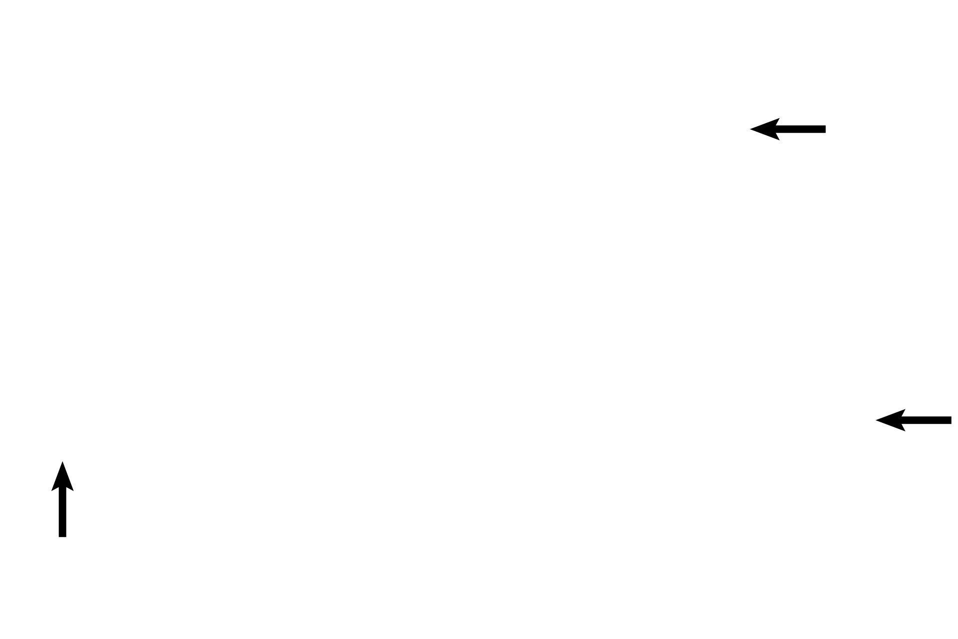 Bronchiolar vessels <p>At higher magnification the components of the wall of a bronchiole are apparent. This is a larger bronchiole because it is lined by pseudostratified columnar epithelium with cilia and goblet cells.  Abundant, longitudinally arranged elastic fibers are located beneath the epithelium. The smooth muscle layer is composed of spiraling bands of smooth muscle. 200x</p>
