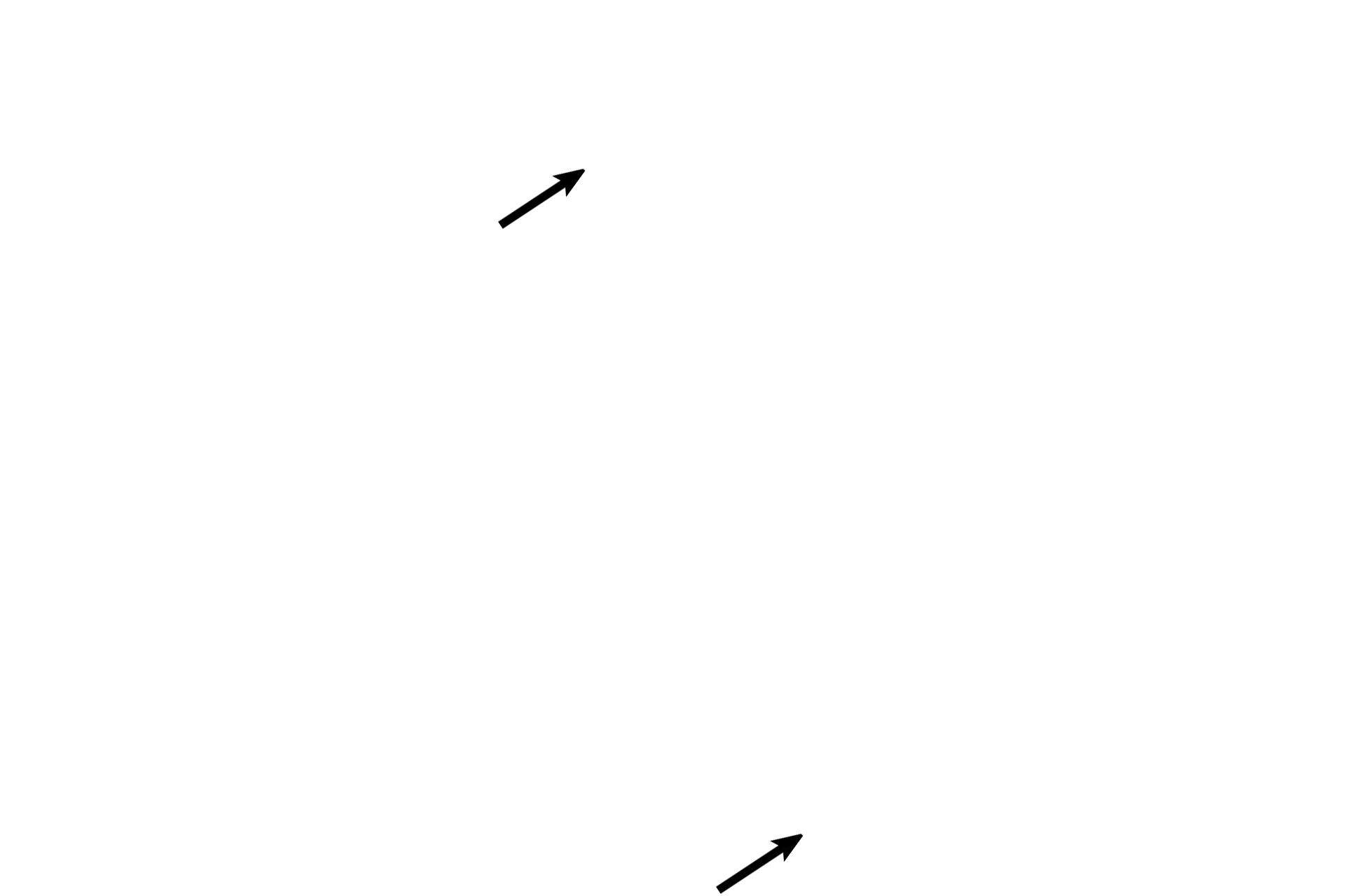 Bronchial blood vessels <p>This smaller bronchiole is still lined by a pseudostratified columnar epithelium with cilia. The contraction of the thick smooth muscle layer produced the folding typical of this passageway; this muscle reaches its greatest relative thickness in the bronchiole. No cartilage nor mixed glands are present. 100x</p>
