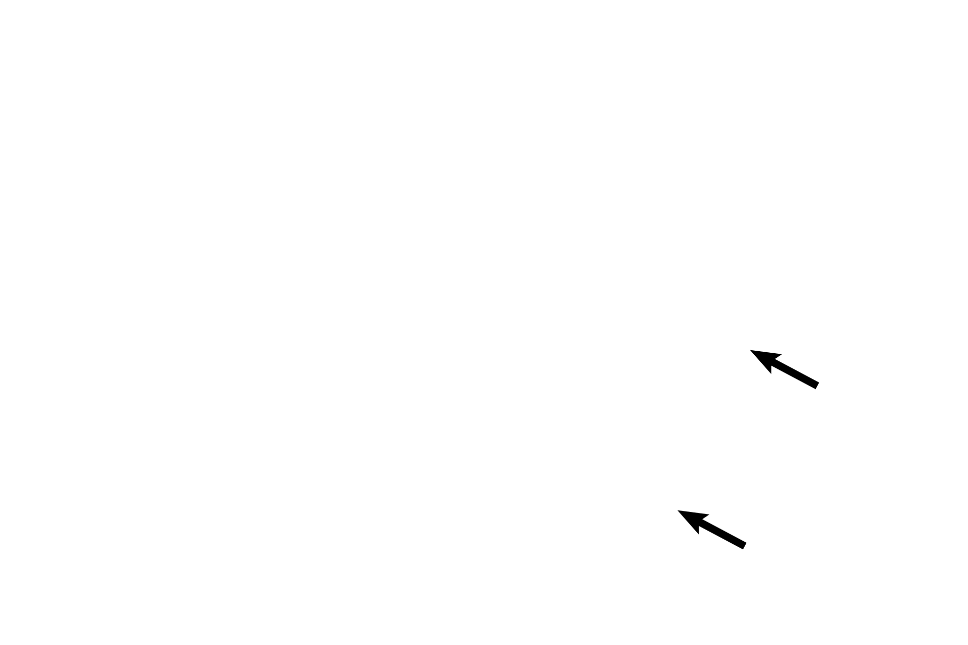  - Basement  membrane <p>The pseudostratified columnar epithelium of the larger bronchioles decreases in height as bronchioles decrease in diameter. This bronchiole is lined by a simple columnar epithelium with cilia and goblet cells. 1500x</p>
