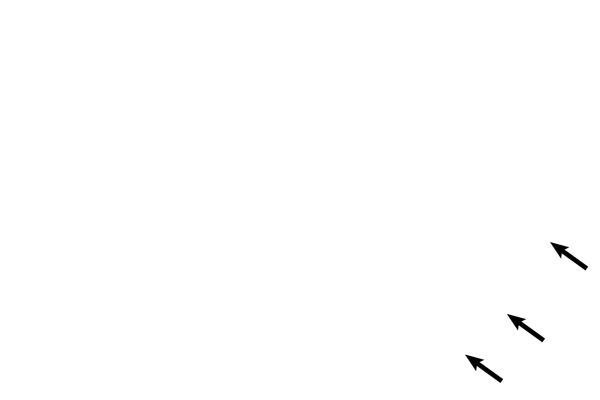  - Elastic fibers <p>The pseudostratified columnar epithelium of the larger bronchioles decreases in height as bronchioles decrease in diameter. This bronchiole is lined by a simple columnar epithelium with cilia and goblet cells. 1500x</p>
