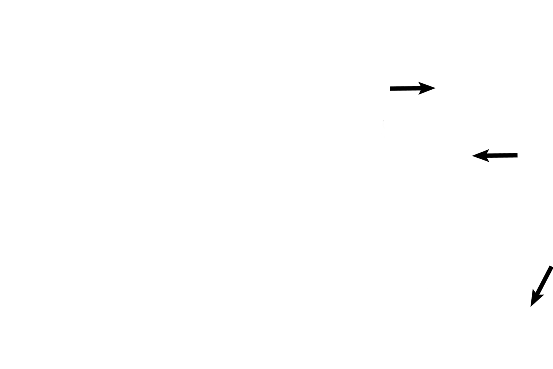  - Club cells <p>The smallest bronchiole (terminal) resembles a larger bronchiole except that it is narrower in diameter and its layers are thinner. The epithelium is simple columnar with cilia; club cells appear for the first time here. Elastic fibers continue in the lamina propria. A smooth muscle layer is still present. 200x, 1000x</p>
