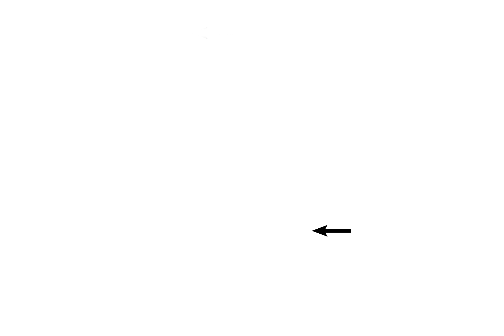 Bronchial vessel <p>The smallest bronchiole (terminal) resembles a larger bronchiole except that it is narrower in diameter and its layers are thinner. The epithelium is simple columnar with cilia; club cells appear for the first time here. Elastic fibers continue in the lamina propria. A smooth muscle layer is still present. 200x, 1000x</p>
