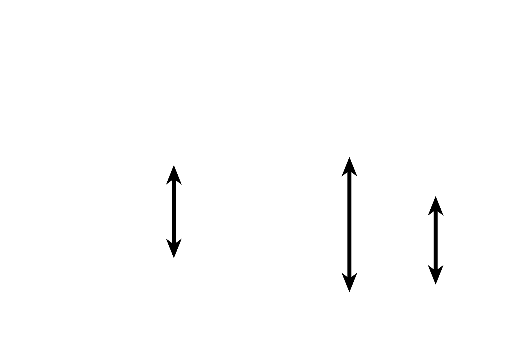 Secondary bronchi <p>Secondary bronchi are intrapulmonary passages that are part of the conducting portion of the respiratory system. As a secondary bronchus branches from a primary, it becomes smaller in diameter and its wall thins. Cartilage plates and mixed glands remain, distinguishing these passages from bronchioles. Pulmonary arteries accompany secondary bronchi. 40x</p>
