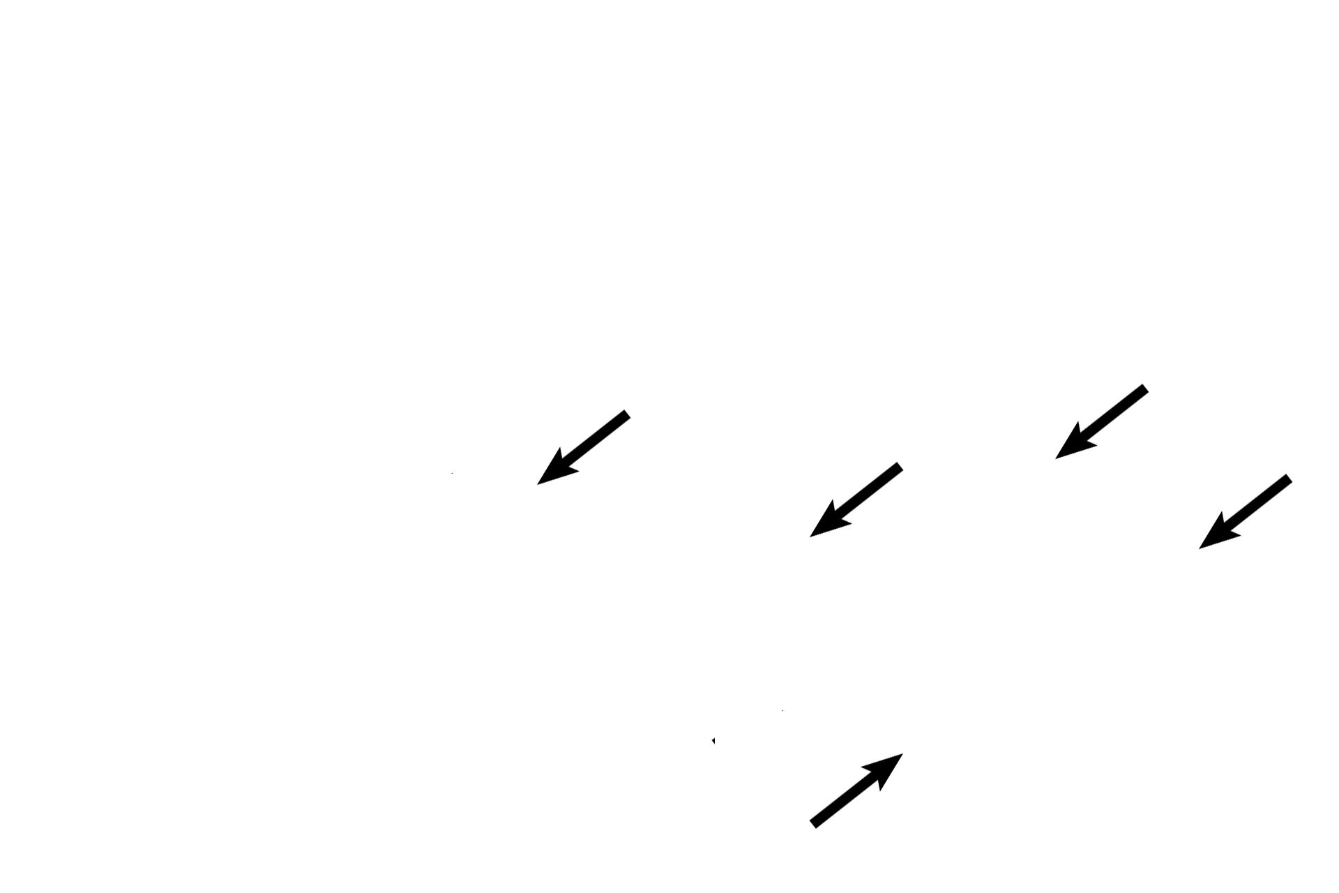 Mixed glands <p>Secondary bronchi are intrapulmonary passages that are part of the conducting portion of the respiratory system. As a secondary bronchus branches from a primary, it becomes smaller in diameter and its wall thins. Cartilage plates and mixed glands remain, distinguishing these passages from bronchioles. Pulmonary arteries accompany secondary bronchi. 40x</p>
