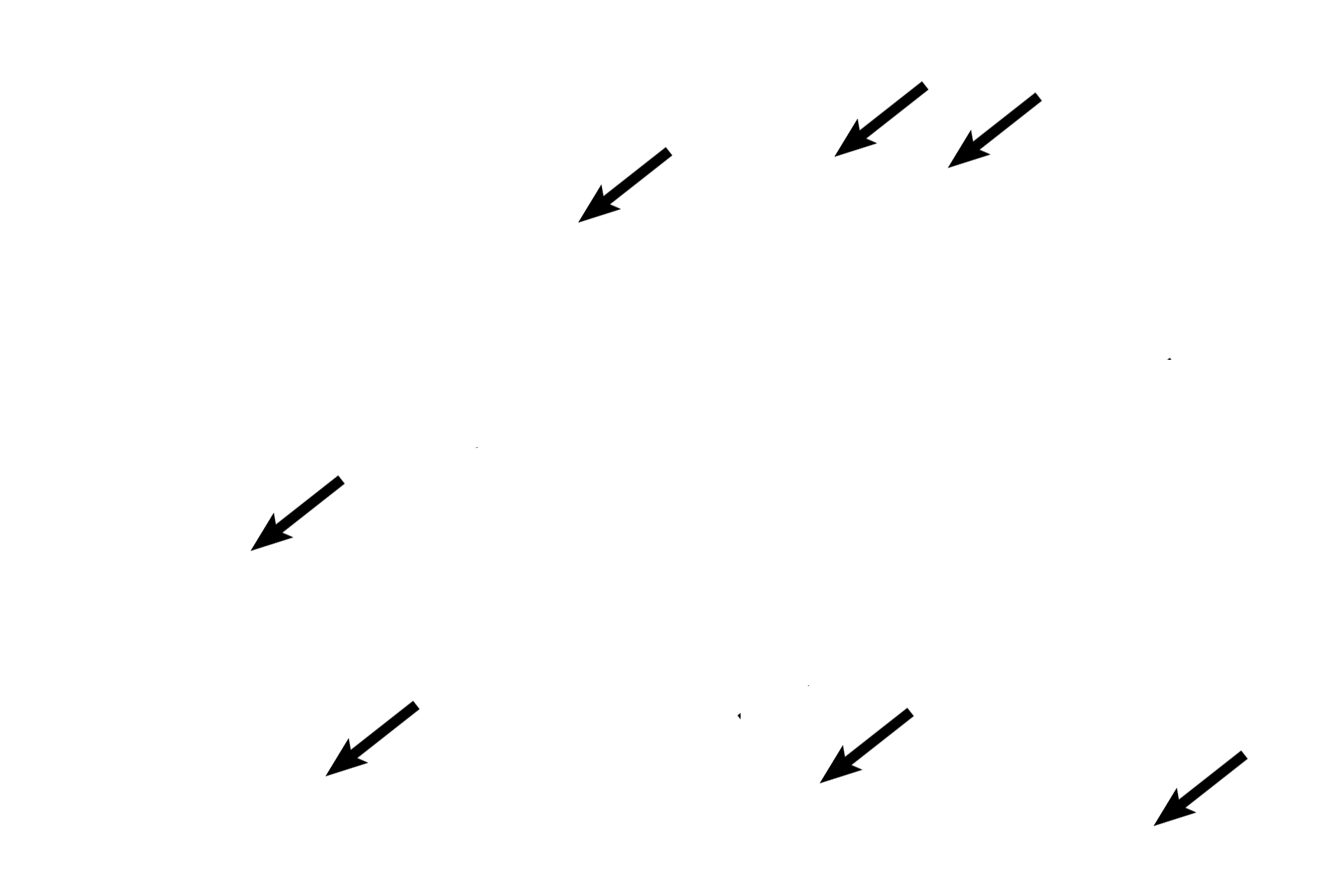 Alveoli <p>Secondary bronchi are intrapulmonary passages that are part of the conducting portion of the respiratory system. As a secondary bronchus branches from a primary, it becomes smaller in diameter and its wall thins. Cartilage plates and mixed glands remain, distinguishing these passages from bronchioles. Pulmonary arteries accompany secondary bronchi. 40x</p>
