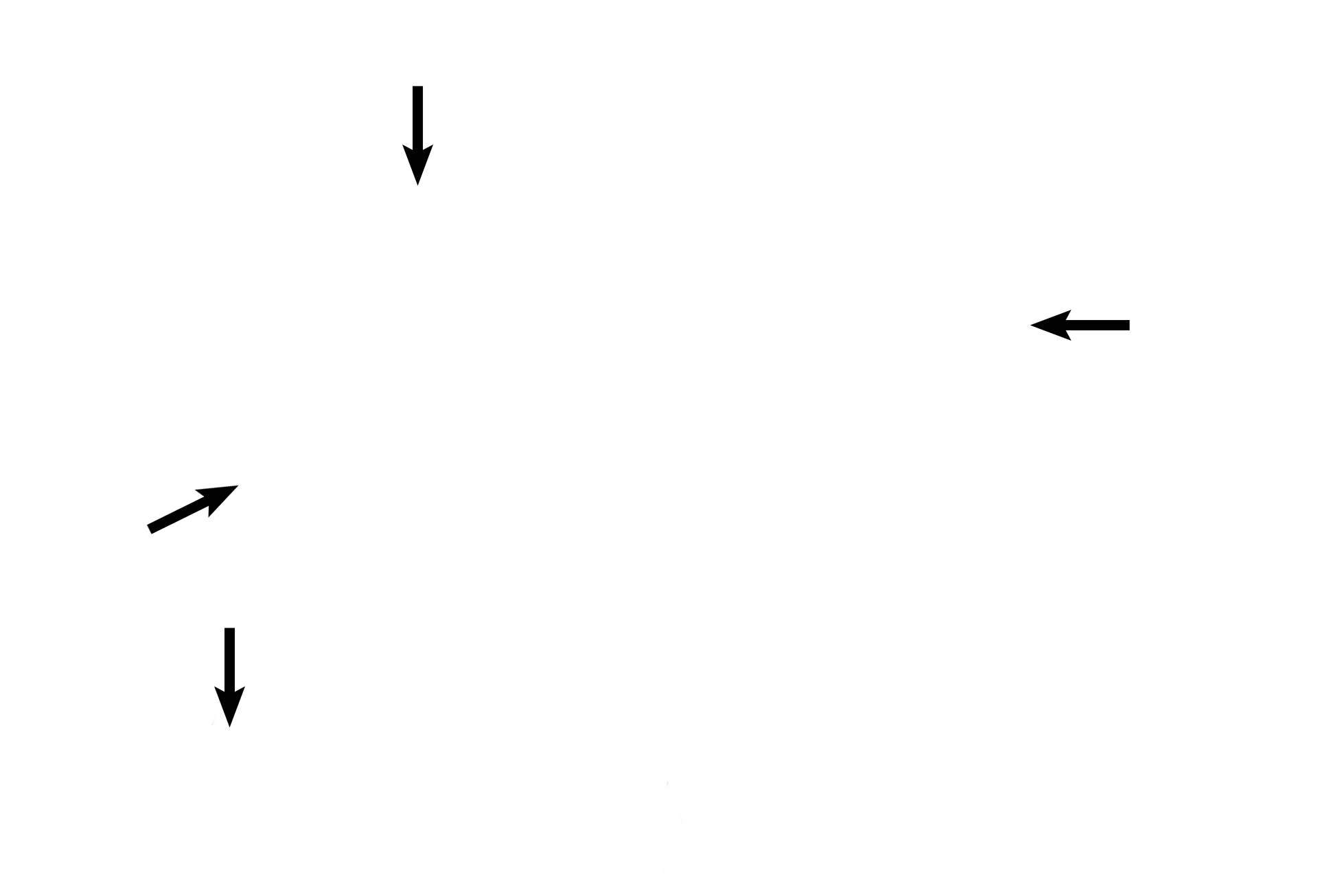  - Smooth muscle <p>Secondary bronchi decrease in diameter and each layer becomes thinner, as the bronchi progress into the lungs. 100x</p>
