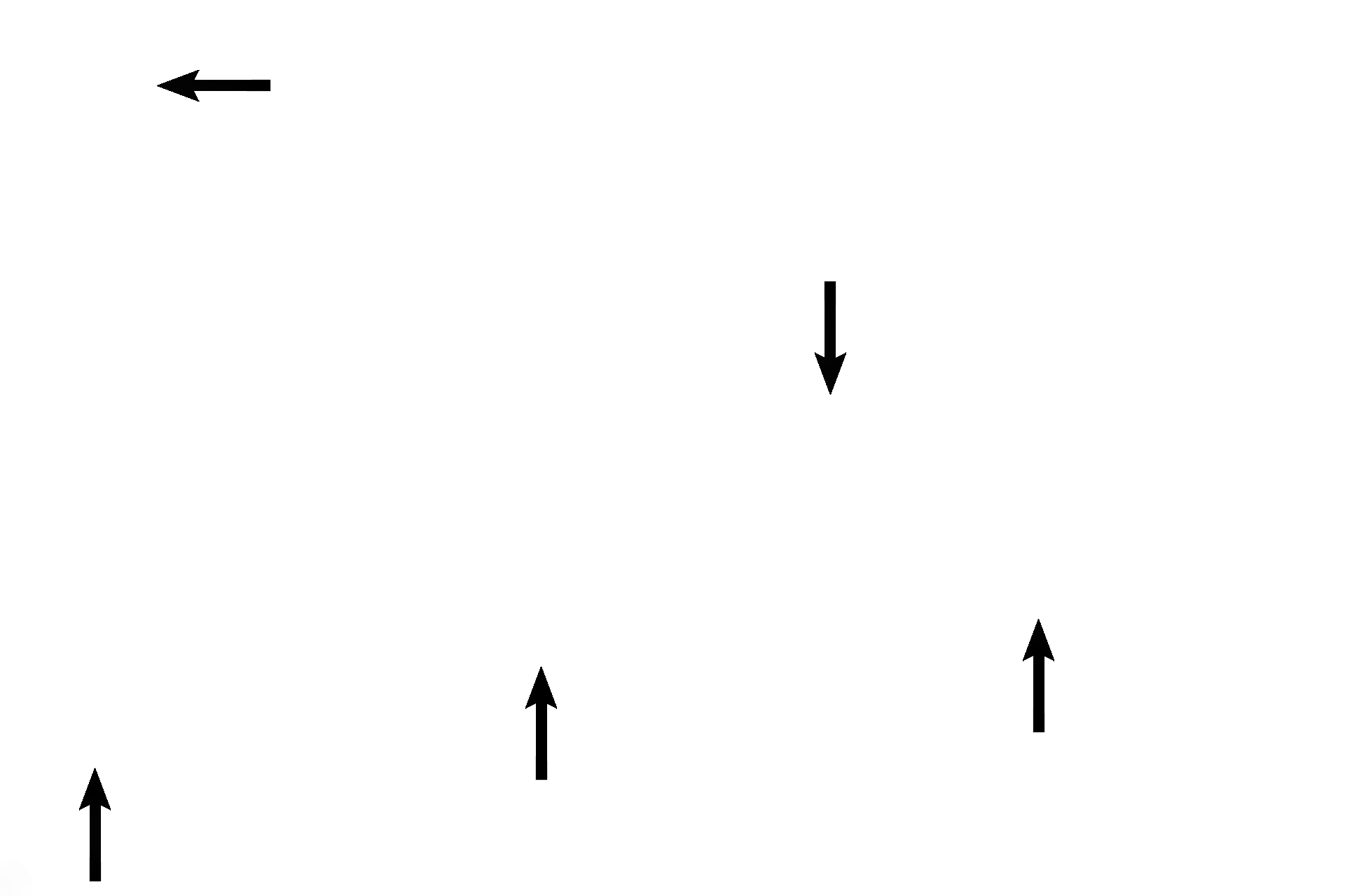 Alveolar lining: Type I cell > <p>A very thin simple squamous epithelium (pulmonary epithelial or type I cell) lines most of the alveolar wall, thus providing the thinnest epithelial lining for gas exchange.</p>

