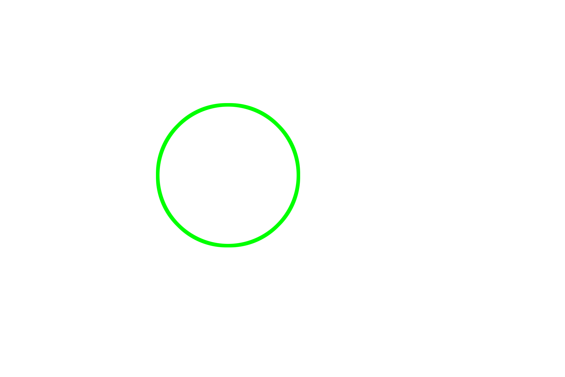 Alveolar lining: Type II cell > <p>Septal cells (type II) also line the alveolar space although they cover far less surface area than does the simple squamous epithelium. Each septal cell can be identified by its frothy cytoplasm, indicative of the phospholipid, surfactant, it secretes. The thin surfactant layer reduces surface tension, thus aiding inflation of the alveoli during inspiration.</p>
