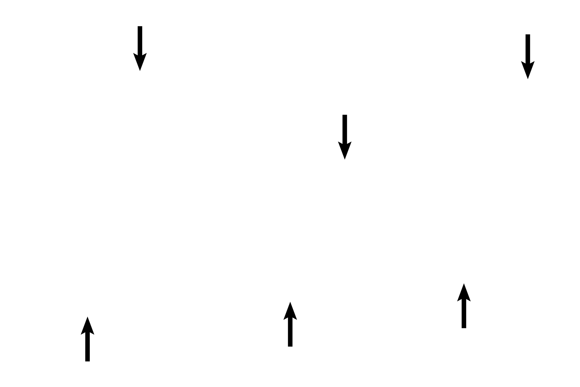 Surfactant <p>Septal cells (type II) also line the alveolar space although they cover far less surface area than does the simple squamous epithelium. Each septal cell can be identified by its frothy cytoplasm, indicative of the phospholipid, surfactant, it secretes. The thin surfactant layer reduces surface tension, thus aiding inflation of the alveoli during inspiration.</p>
