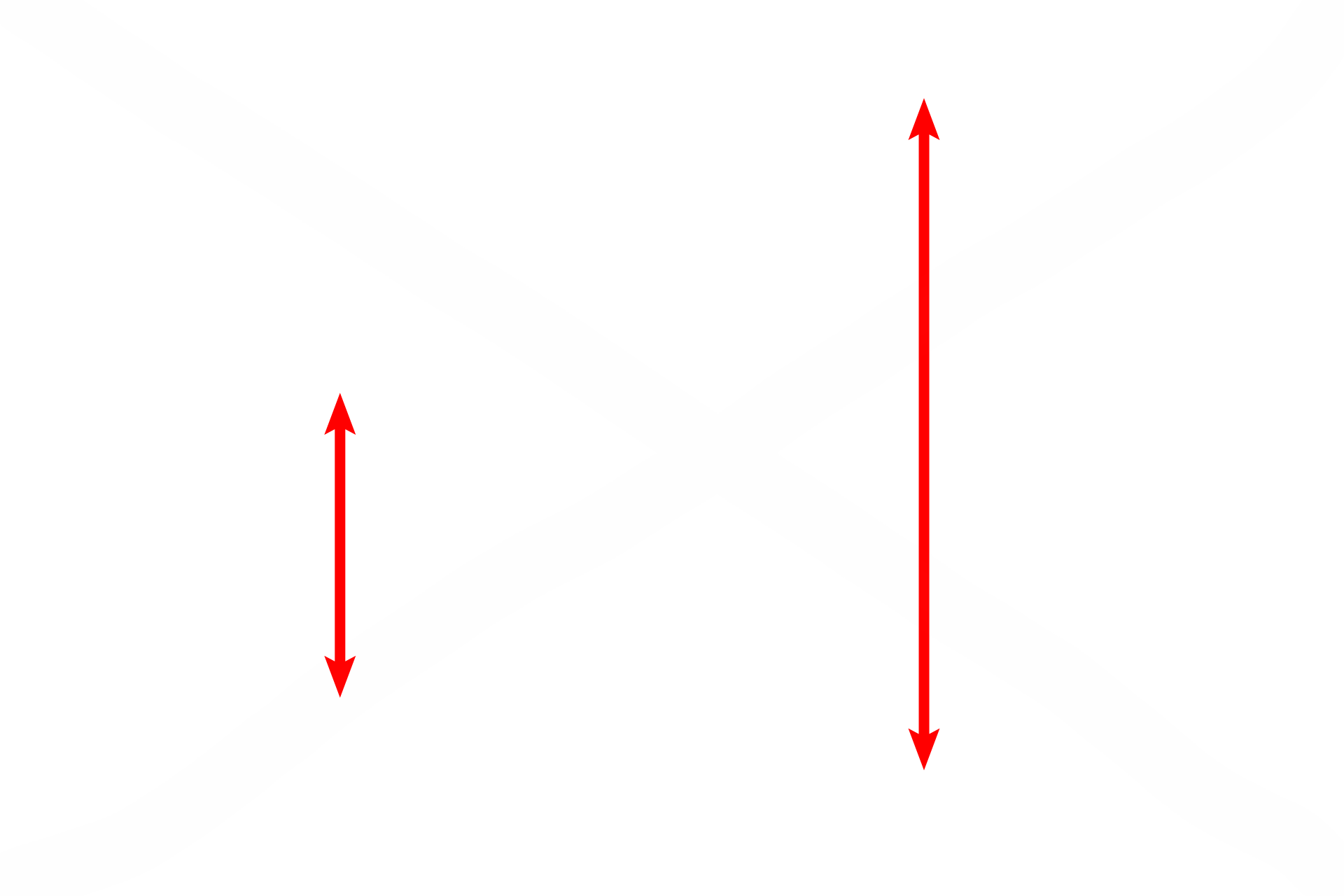 Interalveolar septum <p>This electron micrograph shows many of the components of the interalveolar septum illustrated in the cartoon. The attenuation of type I cell cytoplasm and the protrusion of the capillaries are most evident. Surfactant is not preserved during fixation of lung tissue, and no septal cells nor macrophages are present in this image. 4000x</p>
