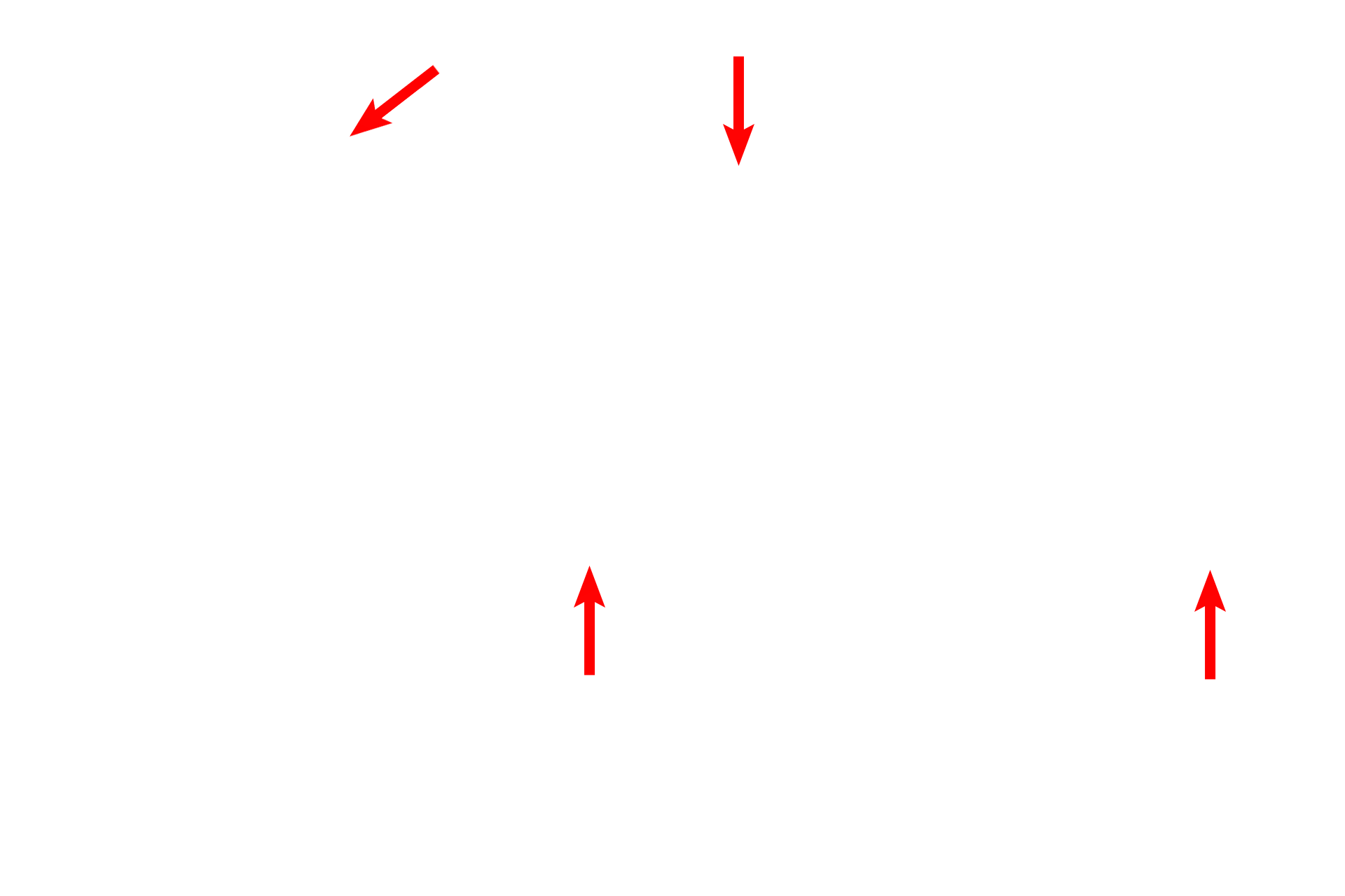  - Type I cells <p>This electron micrograph shows many of the components of the interalveolar septum illustrated in the cartoon. The attenuation of type I cell cytoplasm and the protrusion of the capillaries are most evident. Surfactant is not preserved during fixation of lung tissue, and no septal cells nor macrophages are present in this image. 4000x</p>

