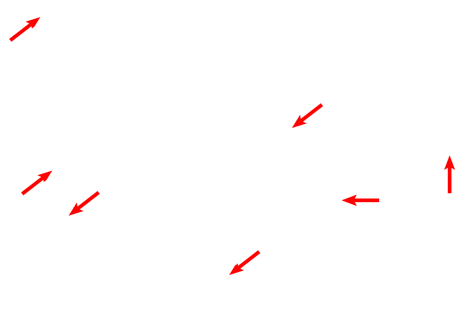  - Endothelial cells <p>This electron micrograph shows many of the components of the interalveolar septum illustrated in the cartoon. The attenuation of type I cell cytoplasm and the protrusion of the capillaries are most evident. Surfactant is not preserved during fixation of lung tissue, and no septal cells nor macrophages are present in this image. 4000x</p>
