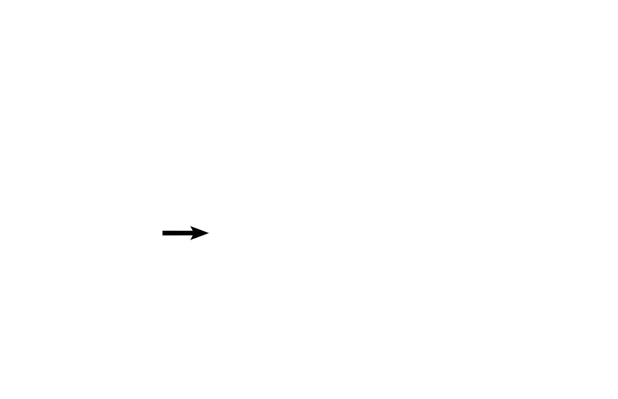 Type II cell <p>Type I cells line the alveolus, their nuclei protrude into the alveolar space.  Endothelial cell nuclei face the capillary lumen and are frequently curved to assume the shape of that lumen. Septal cells (type II alveolar cells) are large, vacuolated cells that bulge into the alveolus.</p>
