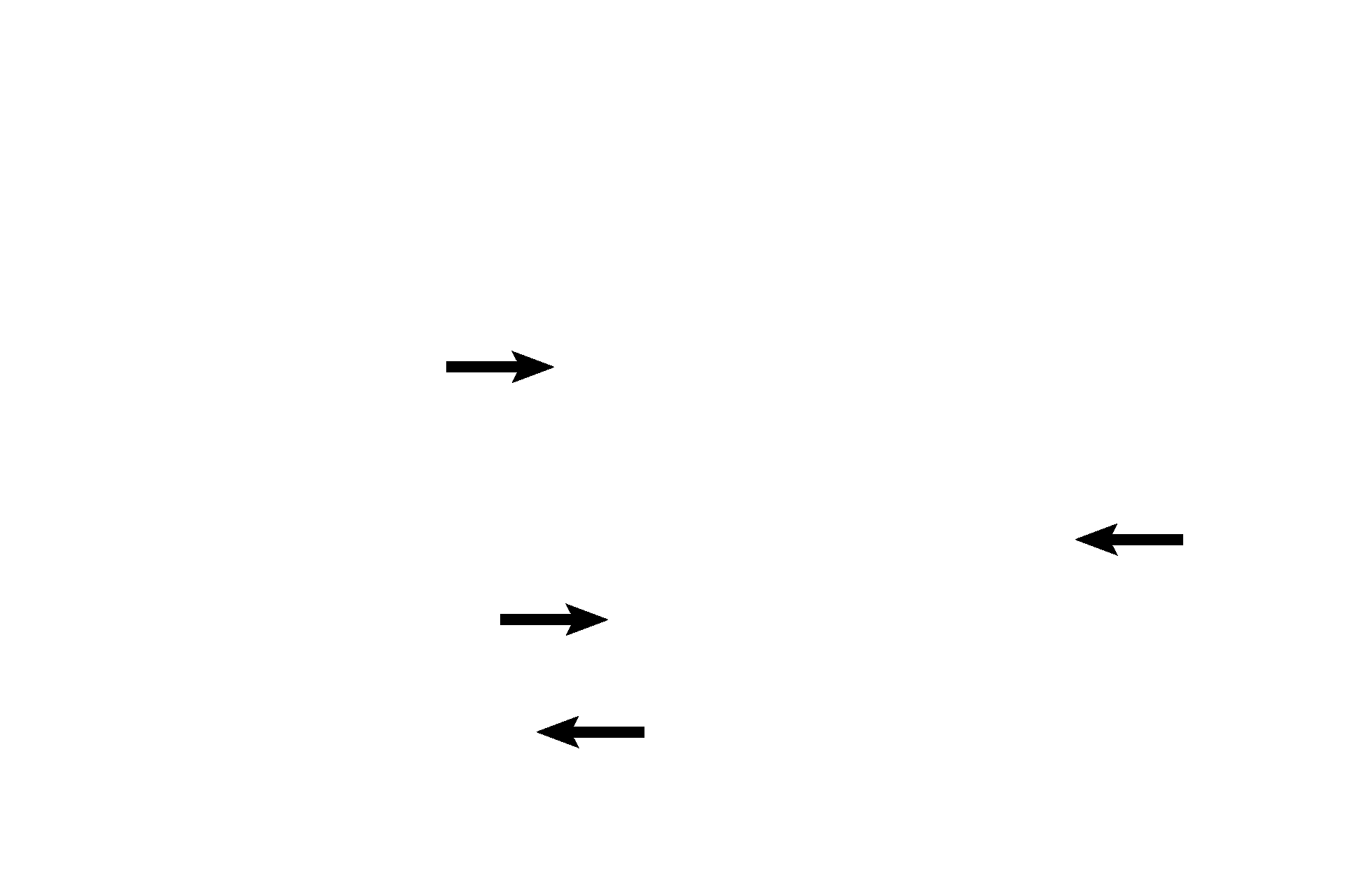 Endothelial cell nuclei <p>The components of the alveoli and the interalveolar septa are illustrated in this image. 1000x</p>
