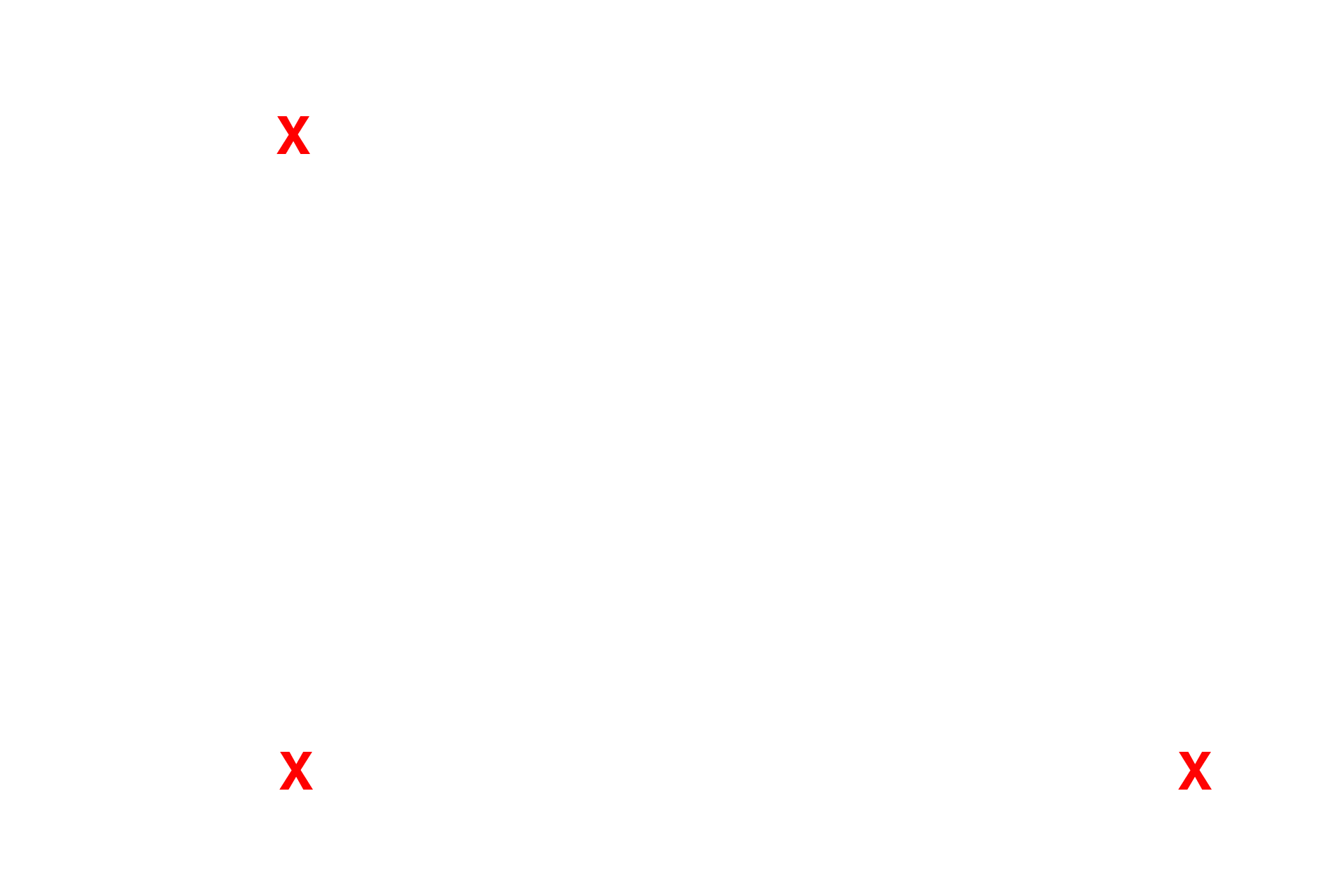 Alveoli <p>With the electron microscope, the details of the interalveolar septum are more obvious. Capillaries bulge into the alveoli. Type I and endothelial nuclei are readily distinguishable. Lamellar bodies and microvilli are obvious on the septal cells. 4000x</p>
