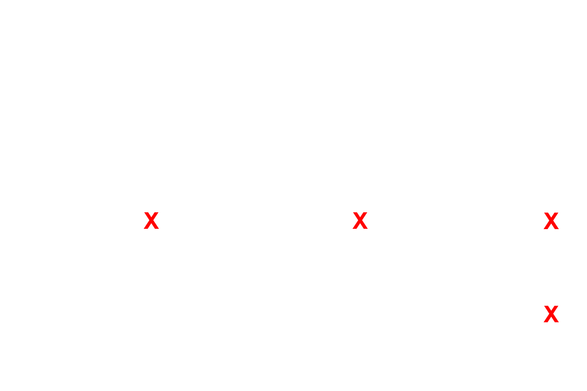  - Capillaries <p>The attenuated cytoplasm of the type I cells lines the interalveolar septum. Septal cells can be identified readily by their vacuoles containing the precursor proteins for surfactant. An alveolar macrophage, lying in in the surfactant layer of the alveolar lumen, is filled with phagocytosed material. 5000x</p>

