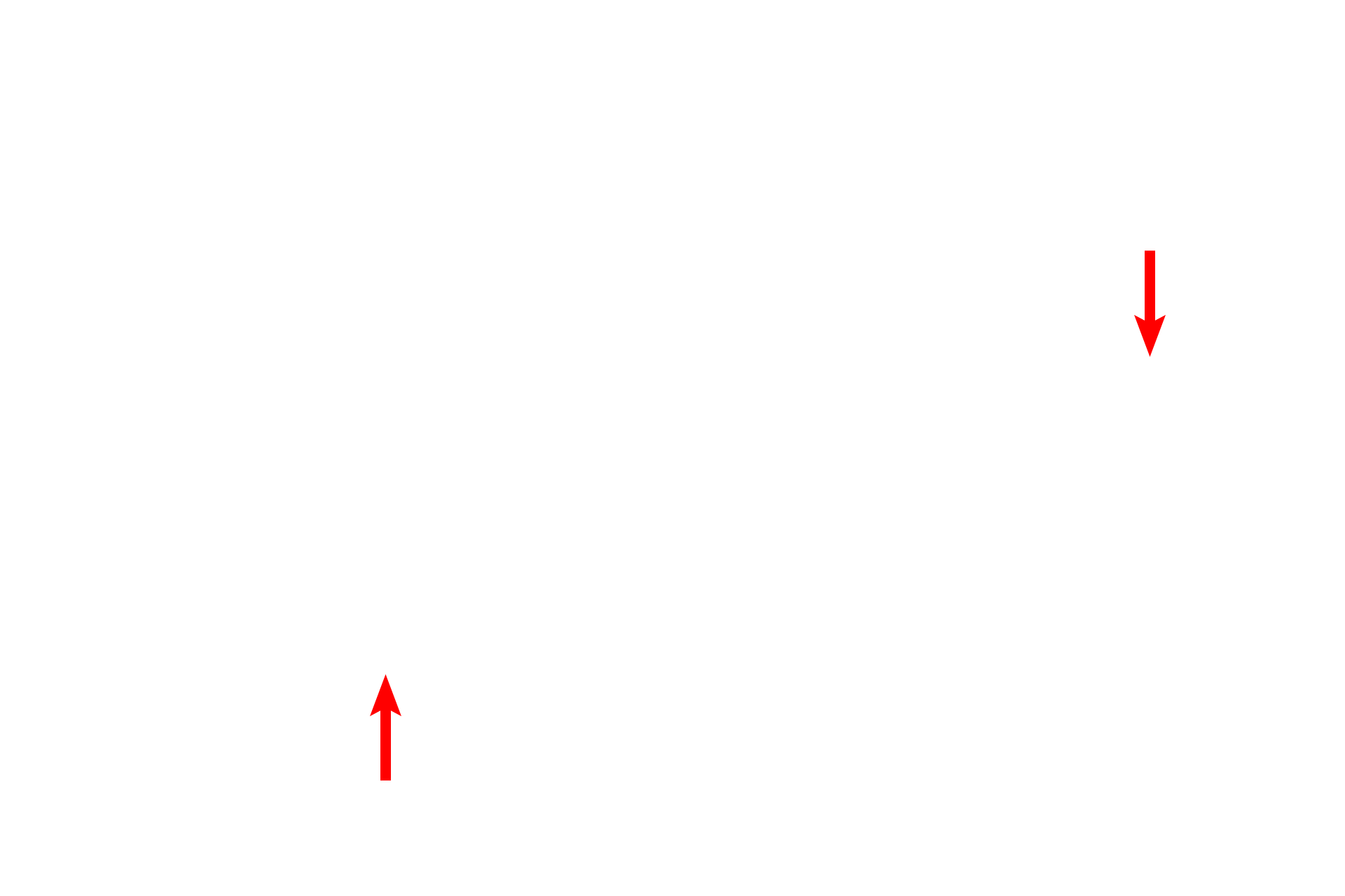  - Endothelial nuclei <p>The attenuated cytoplasm of the type I cells lines the interalveolar septum. Septal cells can be identified readily by their vacuoles containing the precursor proteins for surfactant. An alveolar macrophage, lying in in the surfactant layer of the alveolar lumen, is filled with phagocytosed material. 5000x</p>
