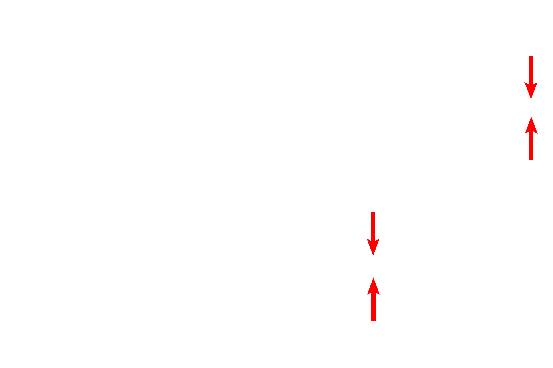 Air-blood barrier <p>The attenuated cytoplasm of the type I cells lines the interalveolar septum. Septal cells can be identified readily by their vacuoles containing the precursor proteins for surfactant. An alveolar macrophage, lying in in the surfactant layer of the alveolar lumen, is filled with phagocytosed material. 5000x</p>
