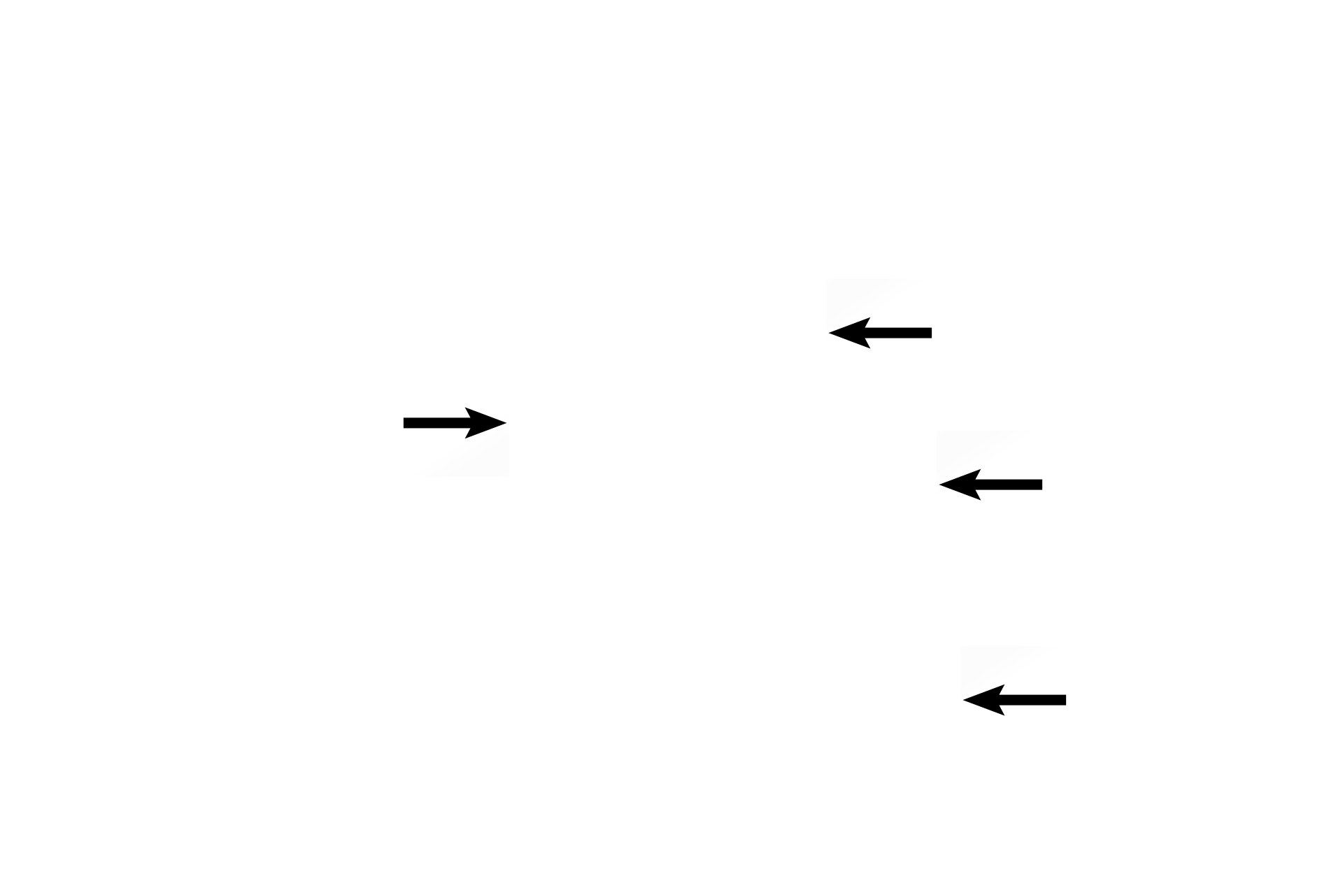 Pulmonary vessels <p>This image demonstrates the transition of terminal bronchiole to respiratory bronchiole to multiple alveolar ducts. 40x</p>
