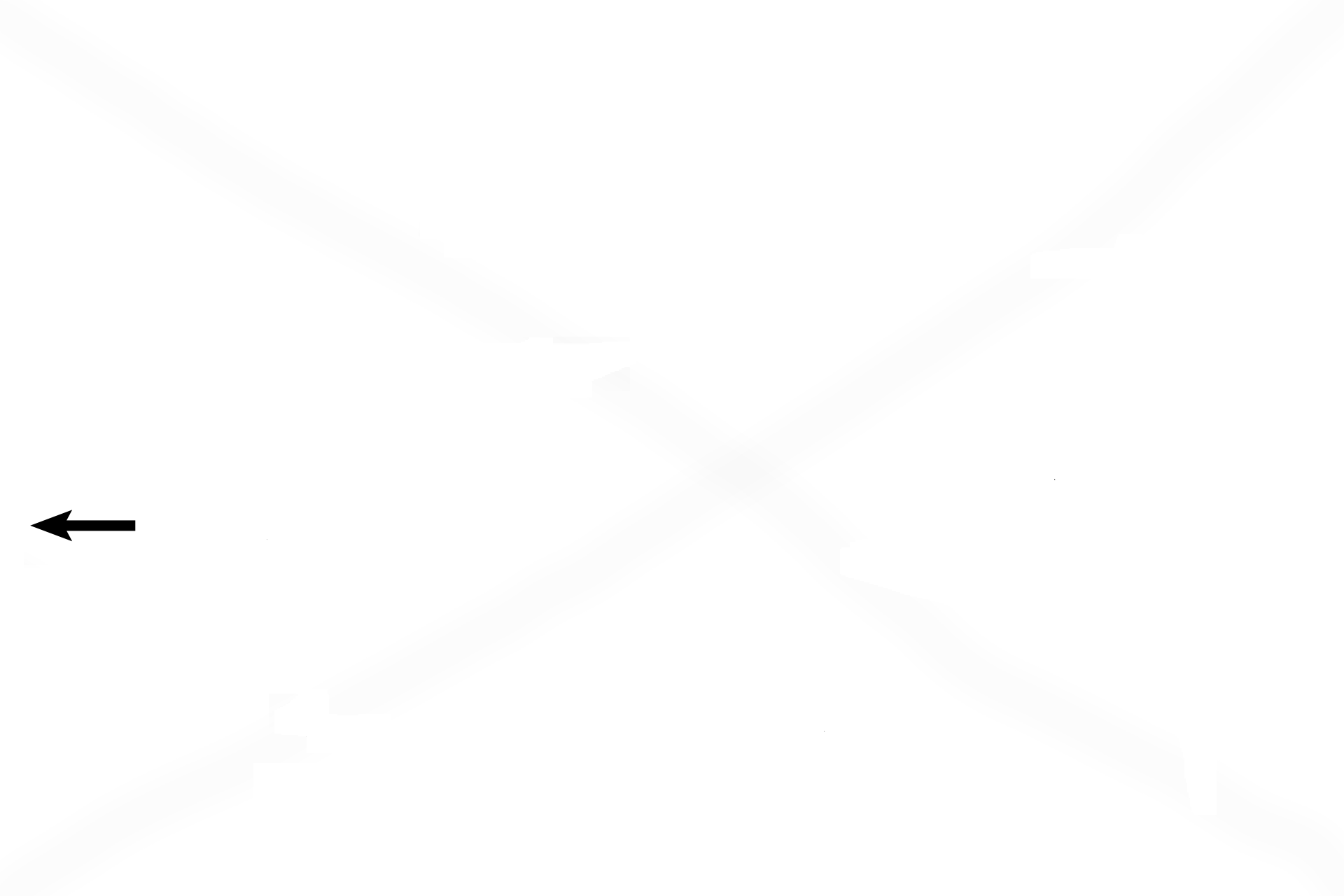  - Type I cell > <p>Type I cells are simple squamous cells that line alveoli. These cells are difficult to distinguish due to the thinness of their cytoplasm. Type I cells can be differentiated from endothelial cells because the nucleus of each cell faces and conforms to the lumen that it lines. Thus, a type I nucleus faces the alveolus and an endothelial cell faces the capillary lumen. </p>

