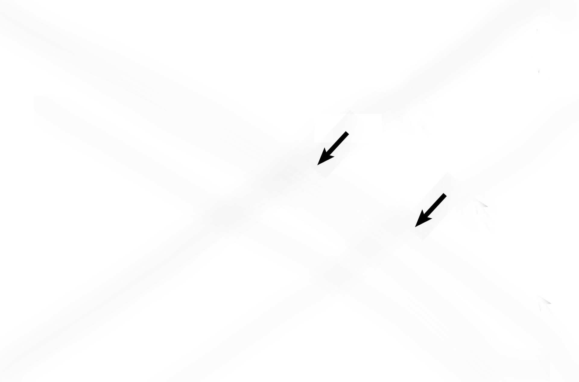 Club cells <p>This transition shows the simple columnar ciliated epithelium of the terminal bronchiole continuing into simple cuboidal epithelium with scattered cilia of the respiratory bronchiole. Club cells are present in both passages, as are longitudinally arranged elastic fibers in lamina propria and a thin muscle layer. 400x</p>

