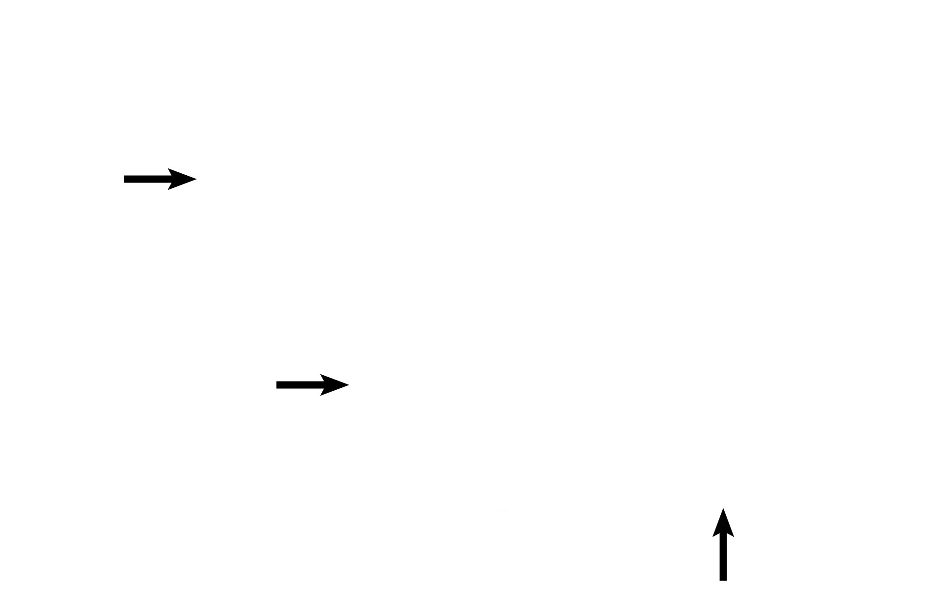 Smooth muscle <p>This transition shows the simple columnar ciliated epithelium of the terminal bronchiole continuing into simple cuboidal epithelium with scattered cilia of the respiratory bronchiole. Club cells are present in both passages, as are longitudinally arranged elastic fibers in lamina propria and a thin muscle layer. 400x</p>
