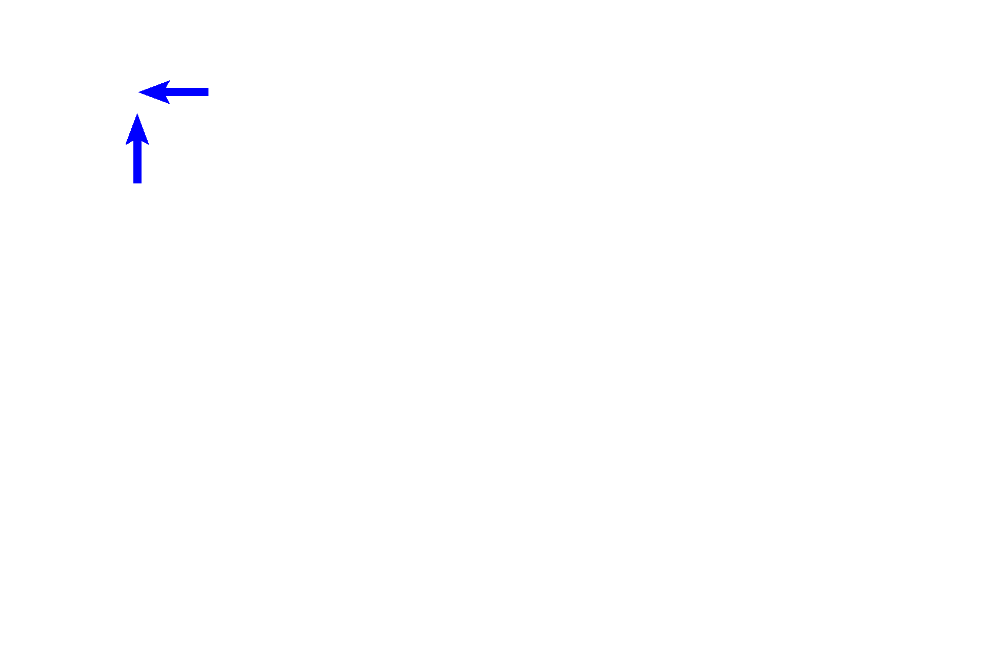 Macrophages > <p>Macrophages, filled with phagocytosed black carbon particles, are located in the connective tissue surrounding the respiratory passageways.</p>
