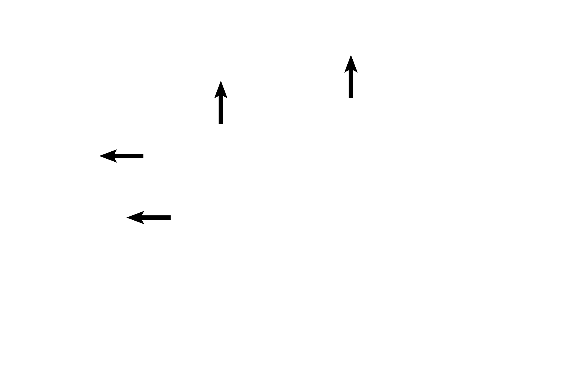 Respiratory bronchiolar wall <p>An edge of a terminal bronchiole is seen transitioning into a respiratory bronchiole. 100x</p>
