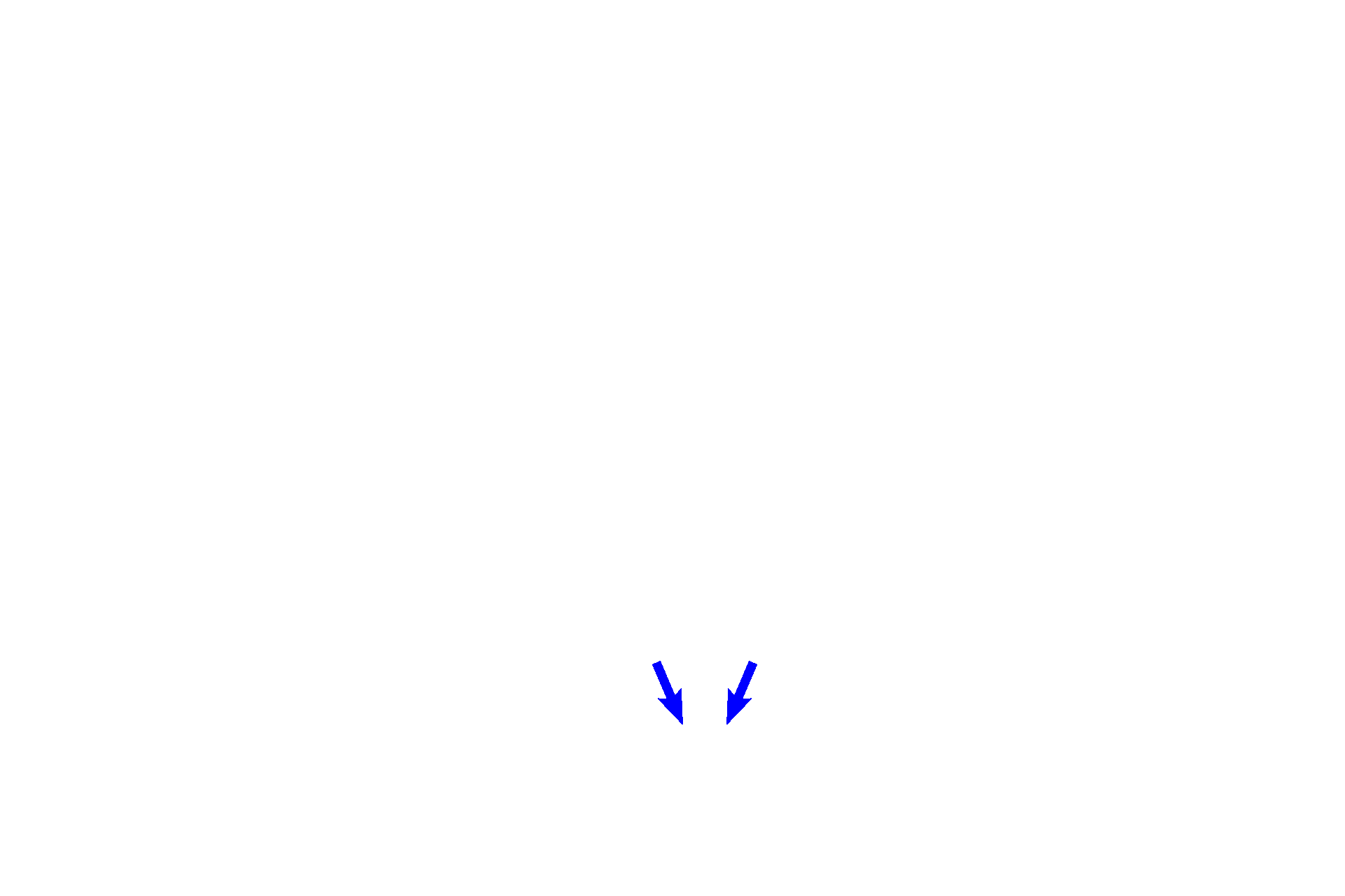 Primary bronchi <p>The extrapulmonary passageways include the nasal cavity, pharynx, larynx, trachea and primary bronchi.  (Images of the pharynx are not included in this program.)</p>
