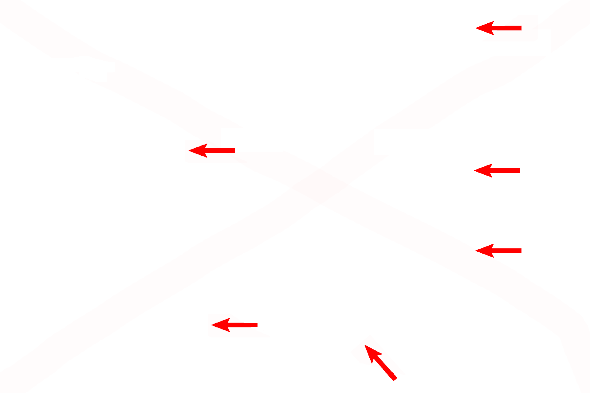 Connective tissue core <p>An electron micrograph illustrates the components of the interalveolar septum separating adjacent alveoli.  3000x</p>
