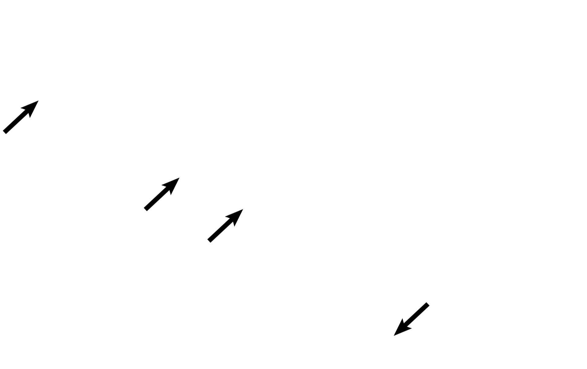  - Mesothelium <p>Visceral pleura covers the exterior of the lung, sending septa into lung tissue proper. Pleura is composed of a mesothelium (simple squamous epithelium) and an underlying connective tissue containing elastic fibers and blood vessels. 200x</p>
