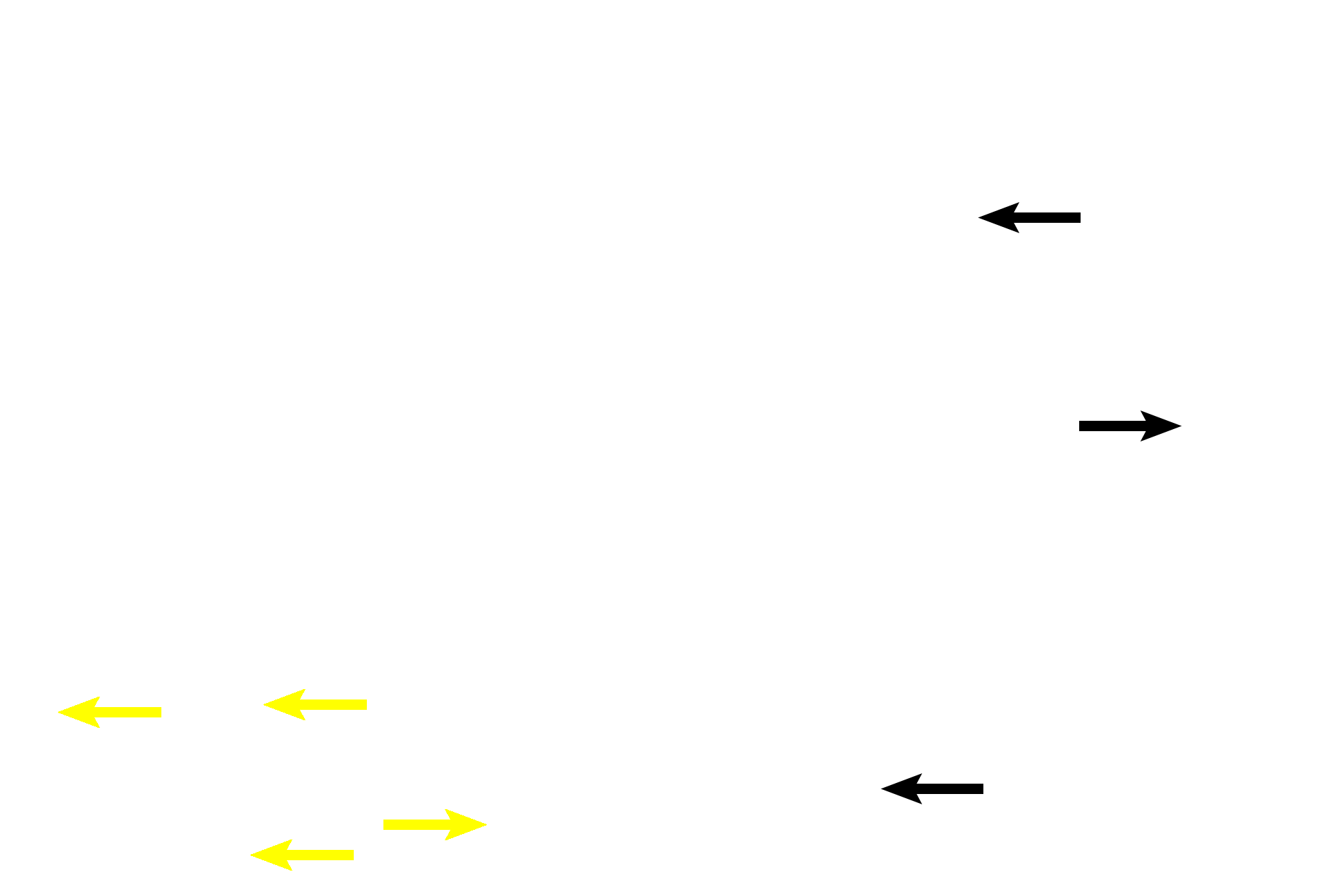 Calcified cartilage > <p>Islands of acellular tissue are present between the two stacks of circumferential lamellae and in the spongy bone. These areas represent the calcified cartilage remnants from the epiphyseal plate. The presence of this calcified cartilage indicates that this central area was produced by endochondral ossification.</p>
