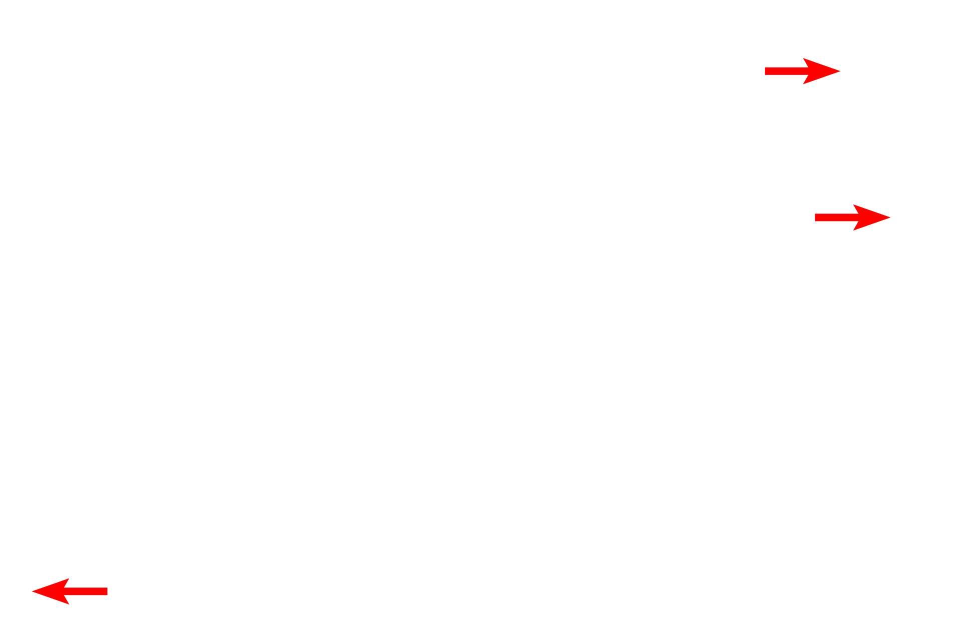 Collagen fibrils <p>This electron micrograph shows two macrophages with indented nuclei and ruffled plasma membranes. The mast cell seen here contains numerous electron-dense, secretory granules throughout its cytoplasm. Its spherical, central nucleus shows moderate, peripheral heterochromatin. 7000x</p>
