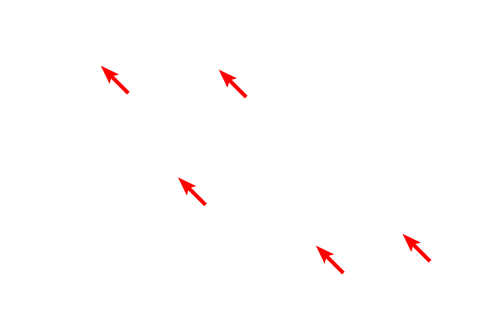 Secretory granules <p>This electron micrograph shows a mast cell in loose connective tissue. The centrally located nucleus is surrounded by numerous secretory granules that contain histamine, heparin and other chemical mediators of the immune response including enzyme proteases.  Bundles of collagen fibrils are also visible. 8,000x</p>

