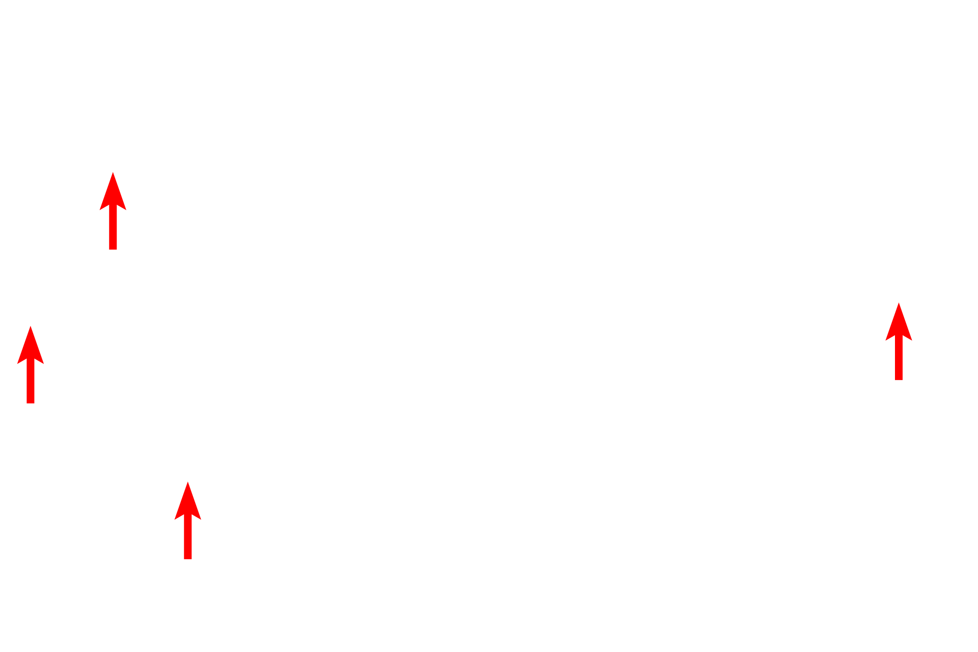 Collagen fibrils <p>This electron micrograph shows a mast cell in loose connective tissue. The centrally located nucleus is surrounded by numerous secretory granules that contain histamine, heparin and other chemical mediators of the immune response including enzyme proteases.  Bundles of collagen fibrils are also visible. 8,000x</p>
