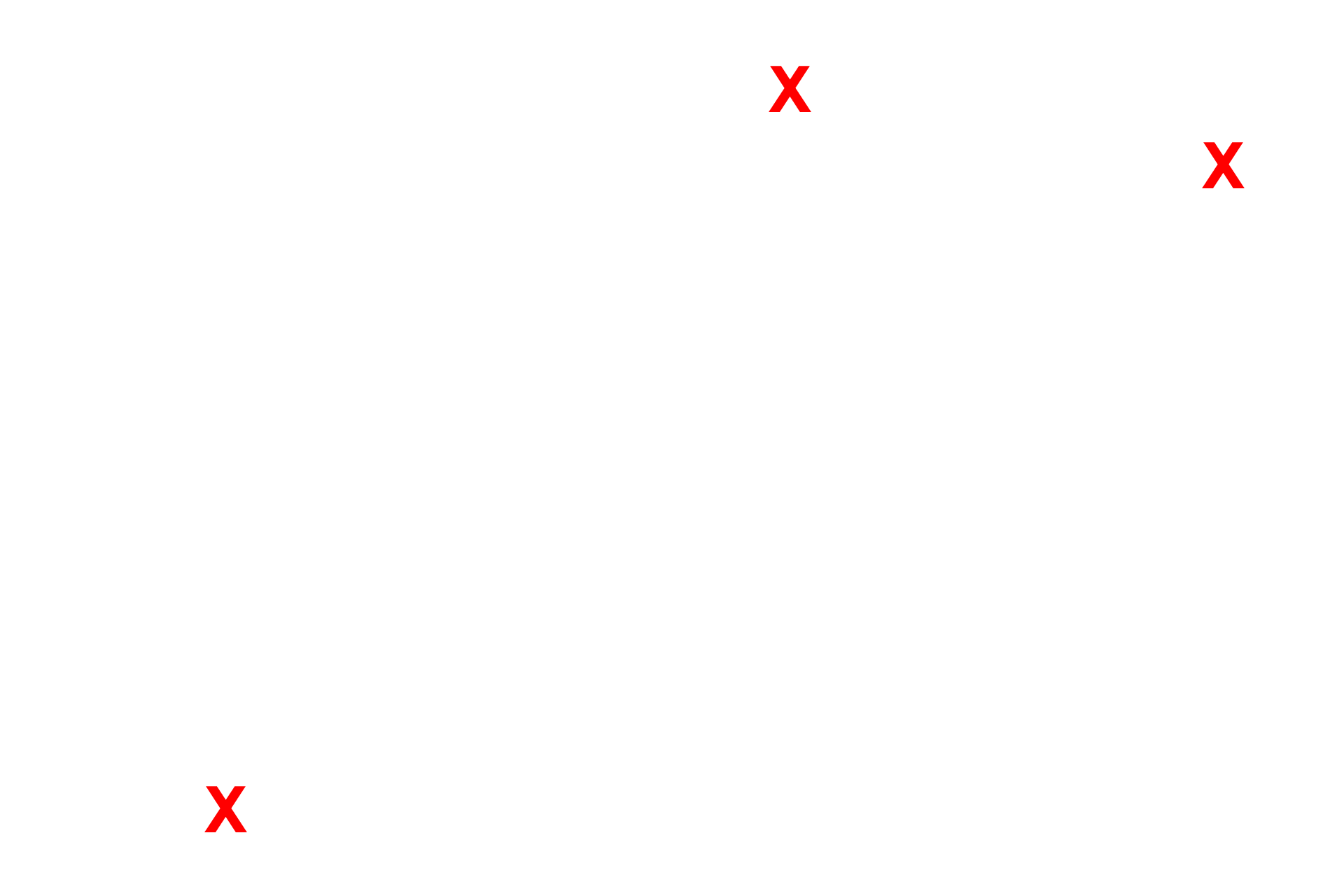 Ground substance <p>This electron micrograph shows a mast cell in loose connective tissue. The centrally located nucleus is surrounded by numerous secretory granules that contain histamine, heparin and other chemical mediators of the immune response including enzyme proteases.  Bundles of collagen fibrils are also visible. 8,000x</p>
