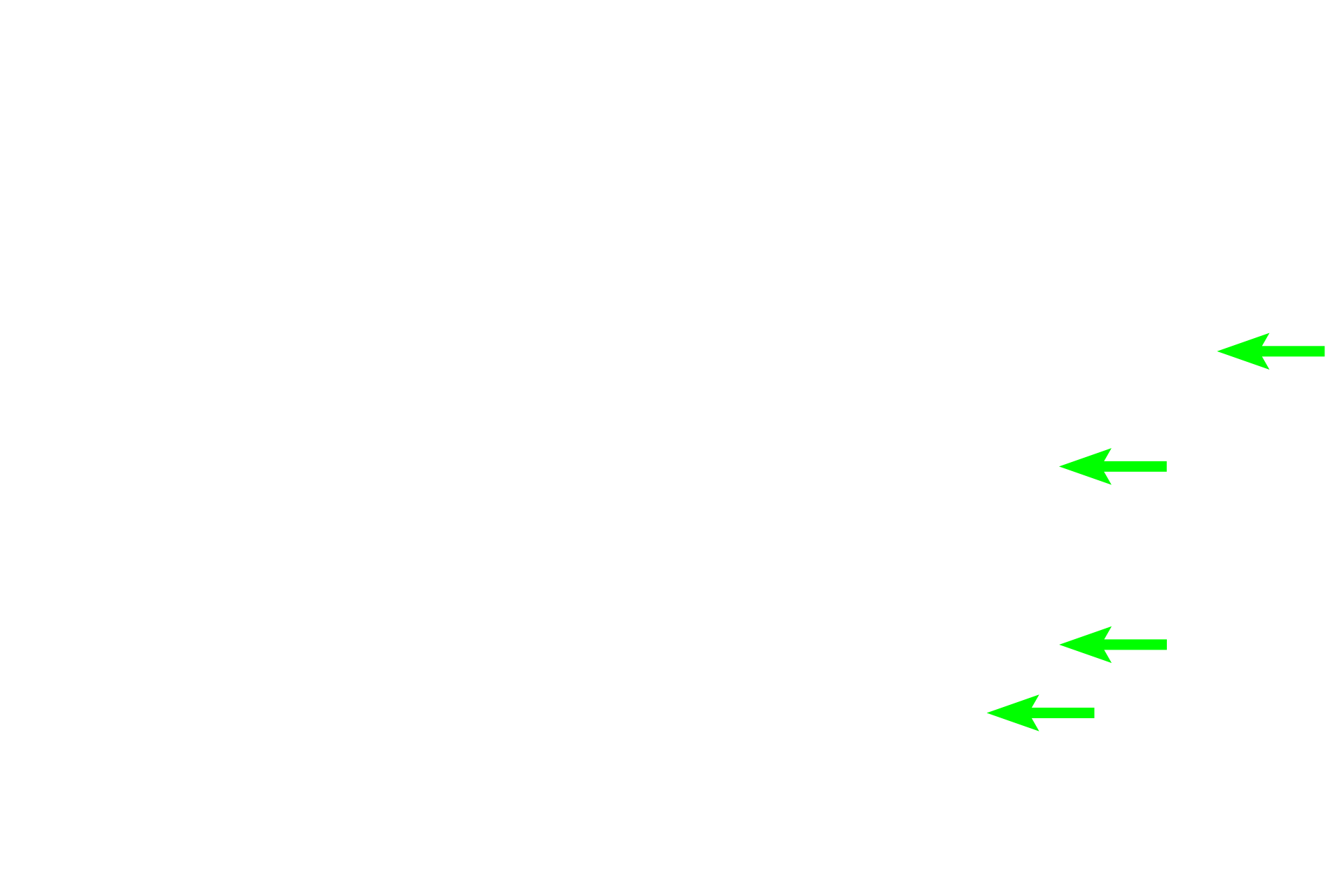  - Plasma cells <p>A typical plasma cell is ovoid and has an eccentric nucleus with heterochromatin frequently arranged to form a clock face. A peripheral rim of cytoplasm stains purple with hematoxylin, due to the presence of rough endoplasmic reticulum. A “negative Golgi” image lies adjacent to the nucleus. These organelles indicate production of protein, antibodies in this case, for release by the cells. 1000x</p>
