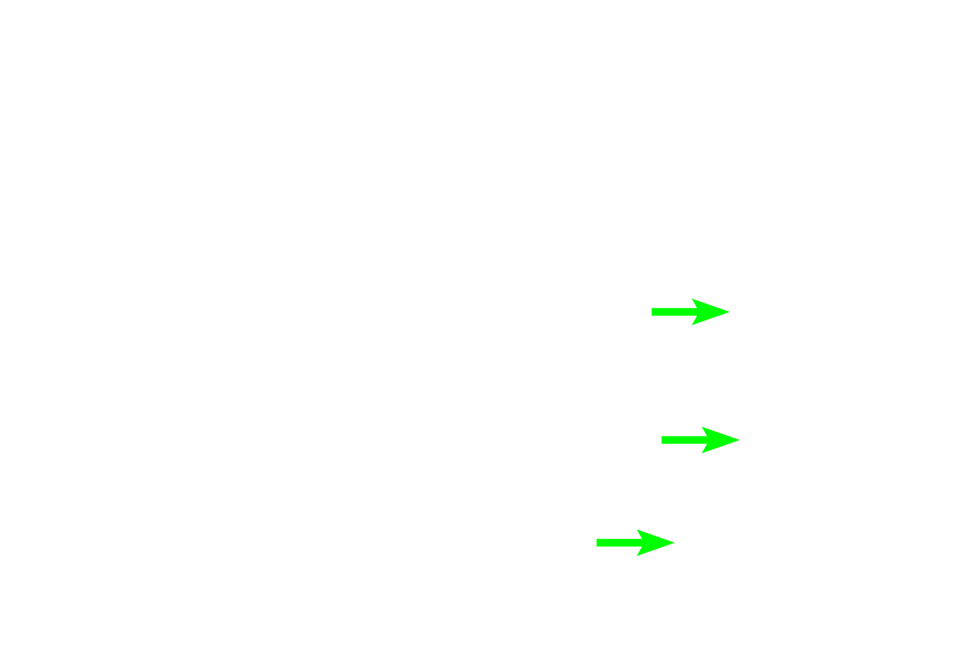 -- Negative Golgi image <p>A typical plasma cell is ovoid and has an eccentric nucleus with heterochromatin frequently arranged to form a clock face. A peripheral rim of cytoplasm stains purple with hematoxylin, due to the presence of rough endoplasmic reticulum. A “negative Golgi” image lies adjacent to the nucleus. These organelles indicate production of protein, antibodies in this case, for release by the cells. 1000x</p>
