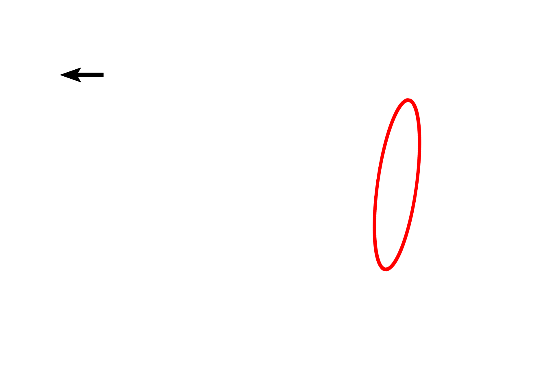 Golgi apparatus <p>Plasma cells have distinctive features that are clearly seen in this electron micrograph: a prominent Golgi; well developed rough endoplasmic reticulum; and a nucleus with large clumps of heterochromatin at the margin of the nucleus (clock-face nucleus). Compare these features with the high magnification light microscopic inset. Plasma cells are derived from B lymphocytes and produce antibodies. 8,000x</p>
